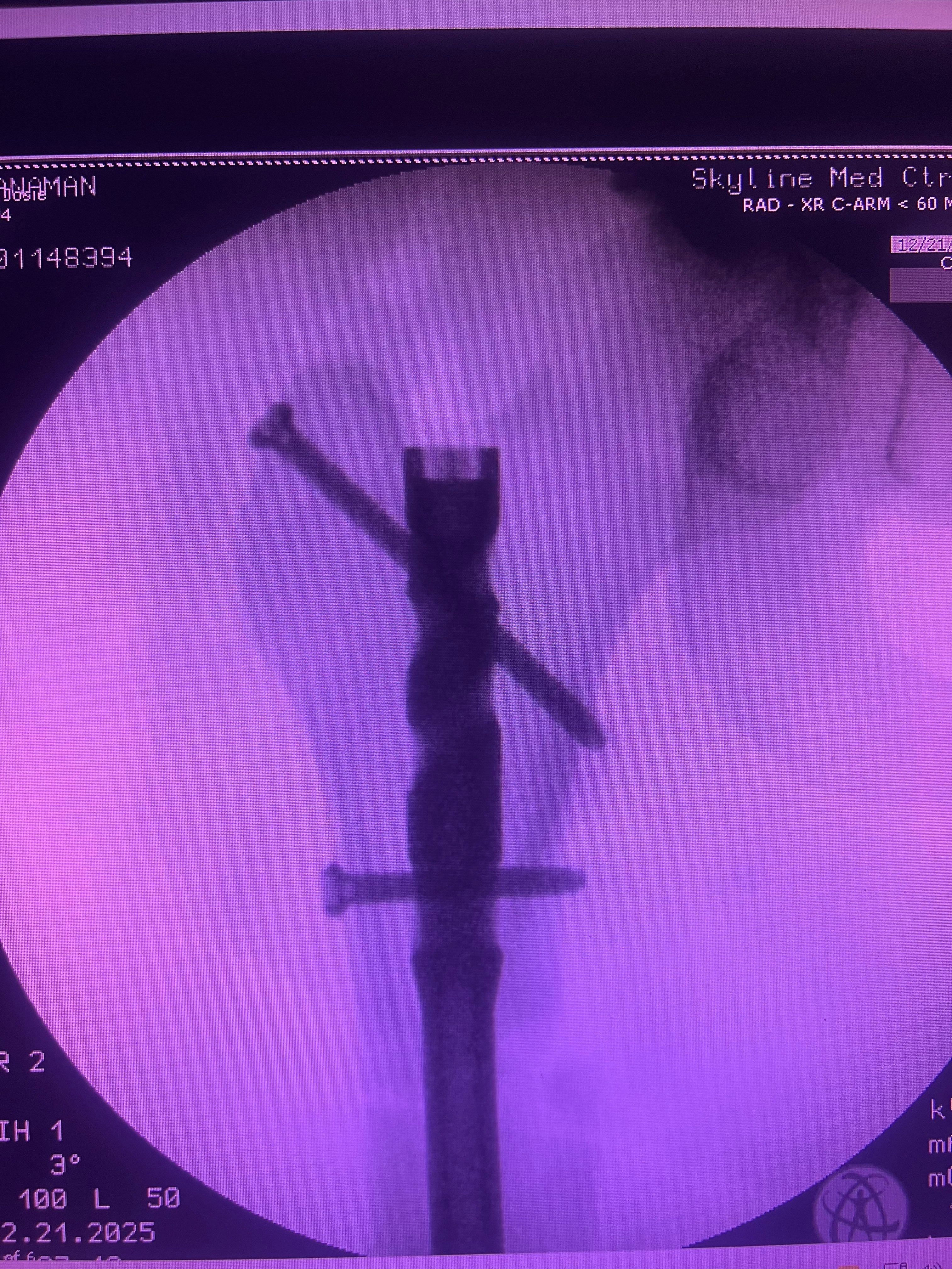 Support Josey’s Recovery After ATV Accident campaign photo, 2 of 5