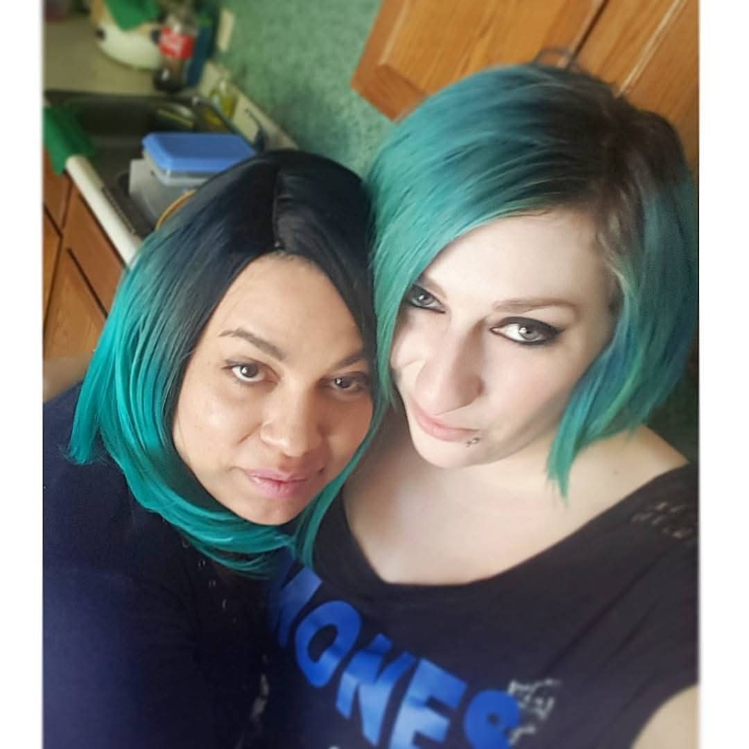 Relief for Jeanine: Surgery for Trigeminal Neuralgia campaign photo, 2 of 8