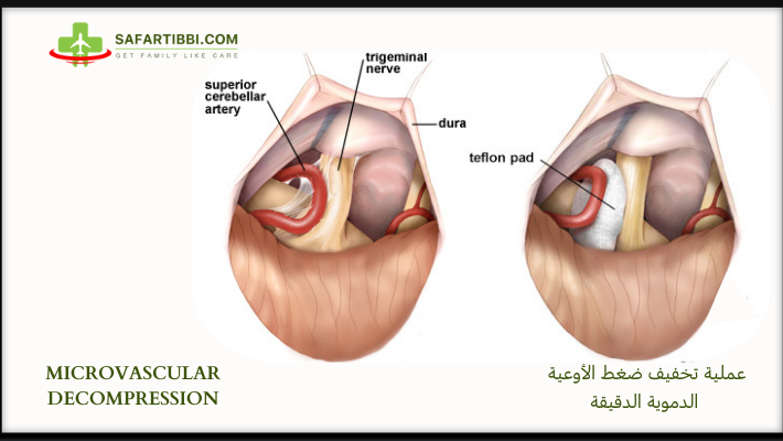 Relief for Jeanine: Surgery for Trigeminal Neuralgia campaign photo, 6 of 8