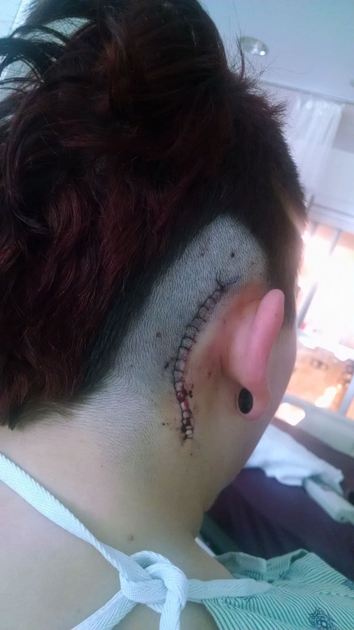 Relief for Jeanine: Surgery for Trigeminal Neuralgia campaign photo, 4 of 8