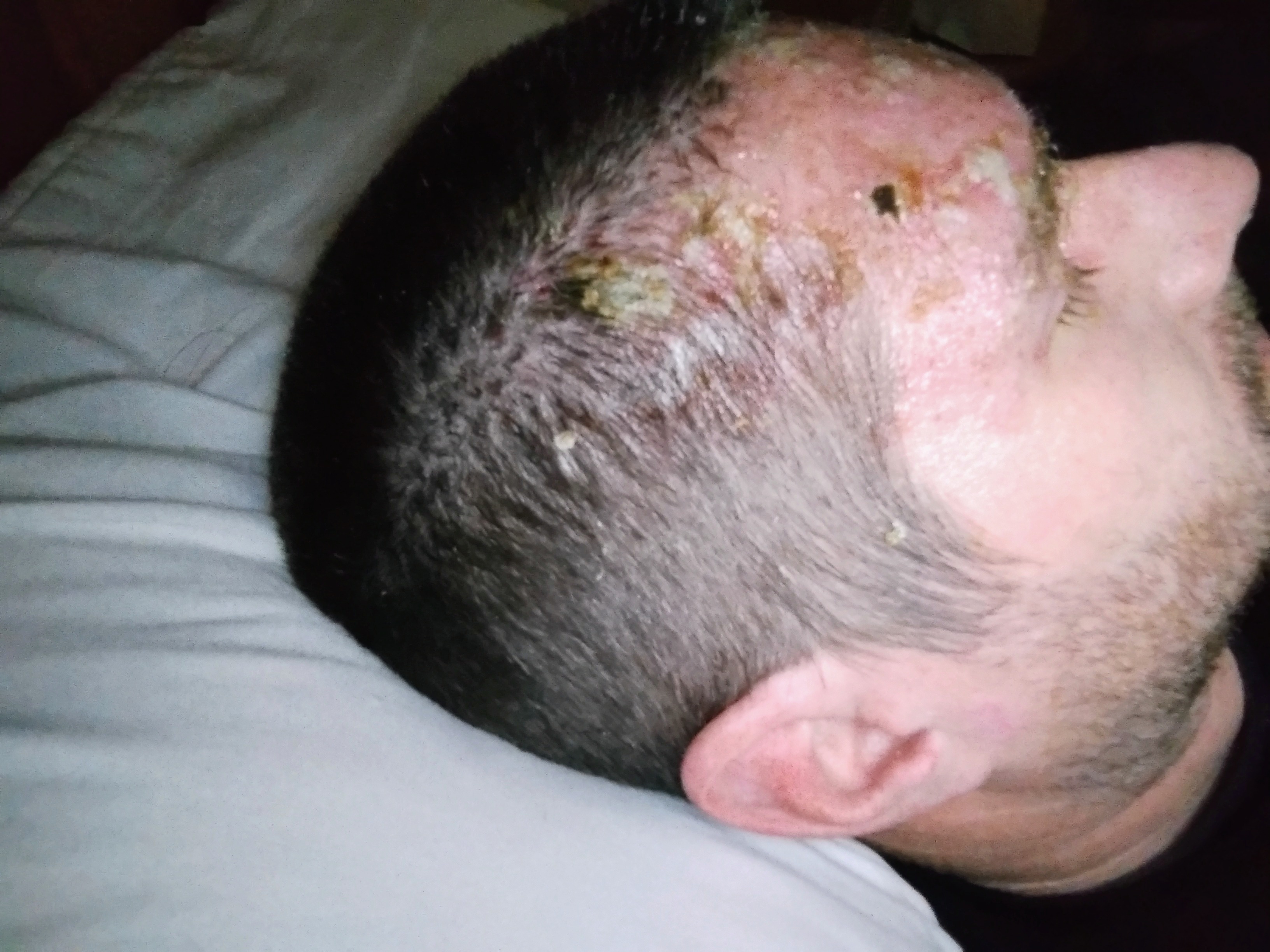 Support Justin Adams Through His Shingles Recovery campaign photo, 7 of 8
