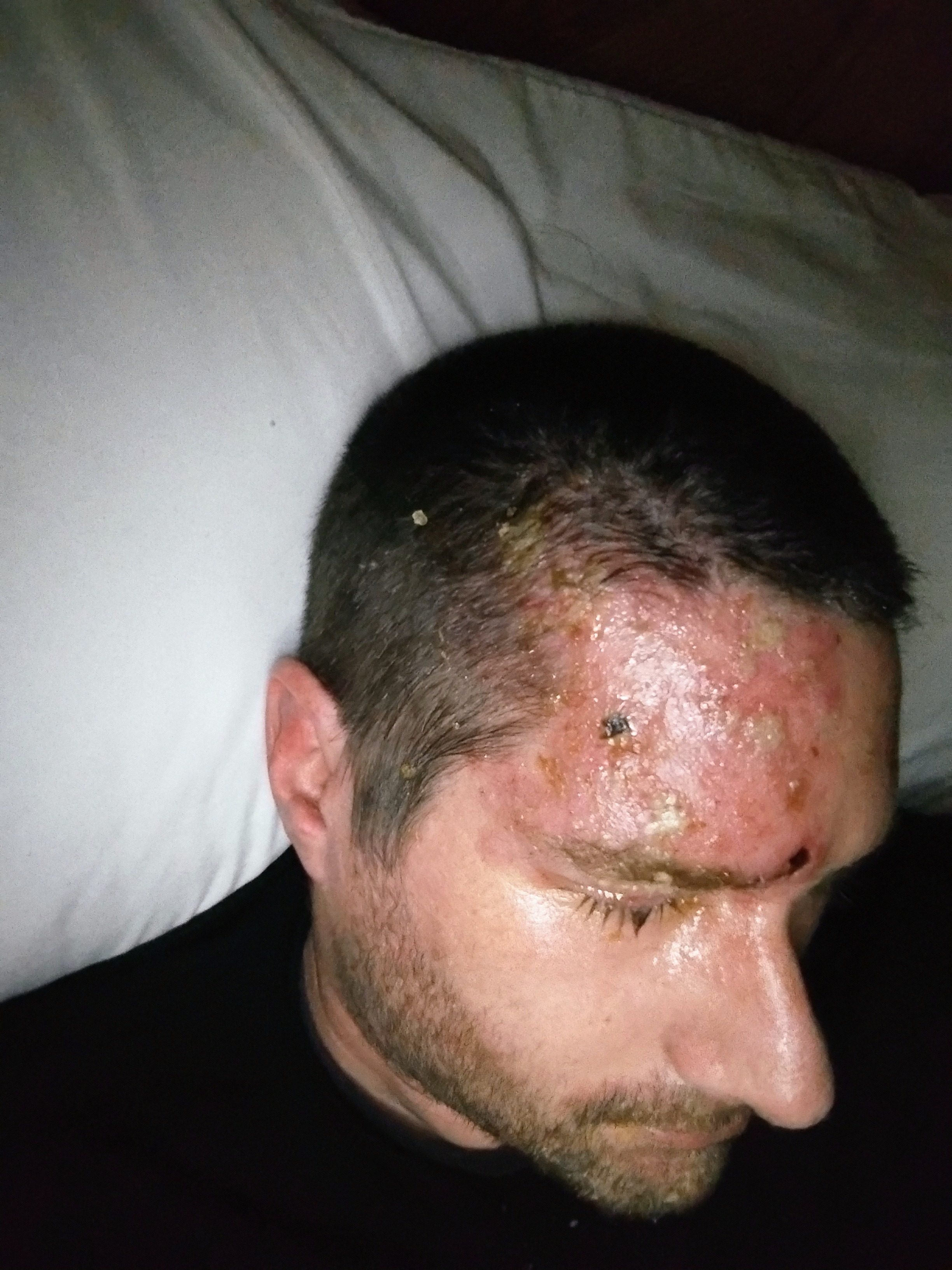 Support Justin Adams Through His Shingles Recovery campaign photo, 2 of 8
