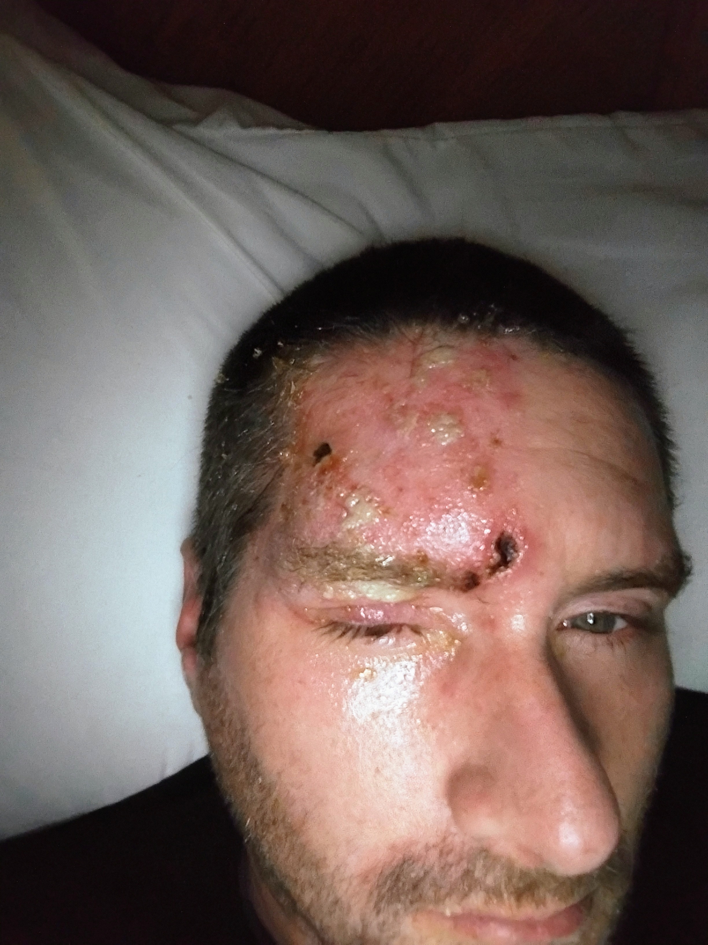 Support Justin Adams Through His Shingles Recovery campaign photo, 4 of 8