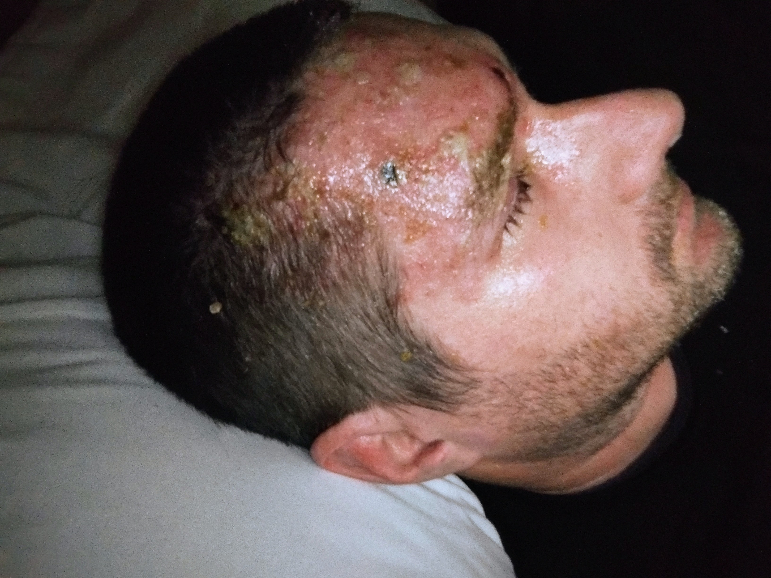 Support Justin Adams Through His Shingles Recovery campaign photo, 5 of 8