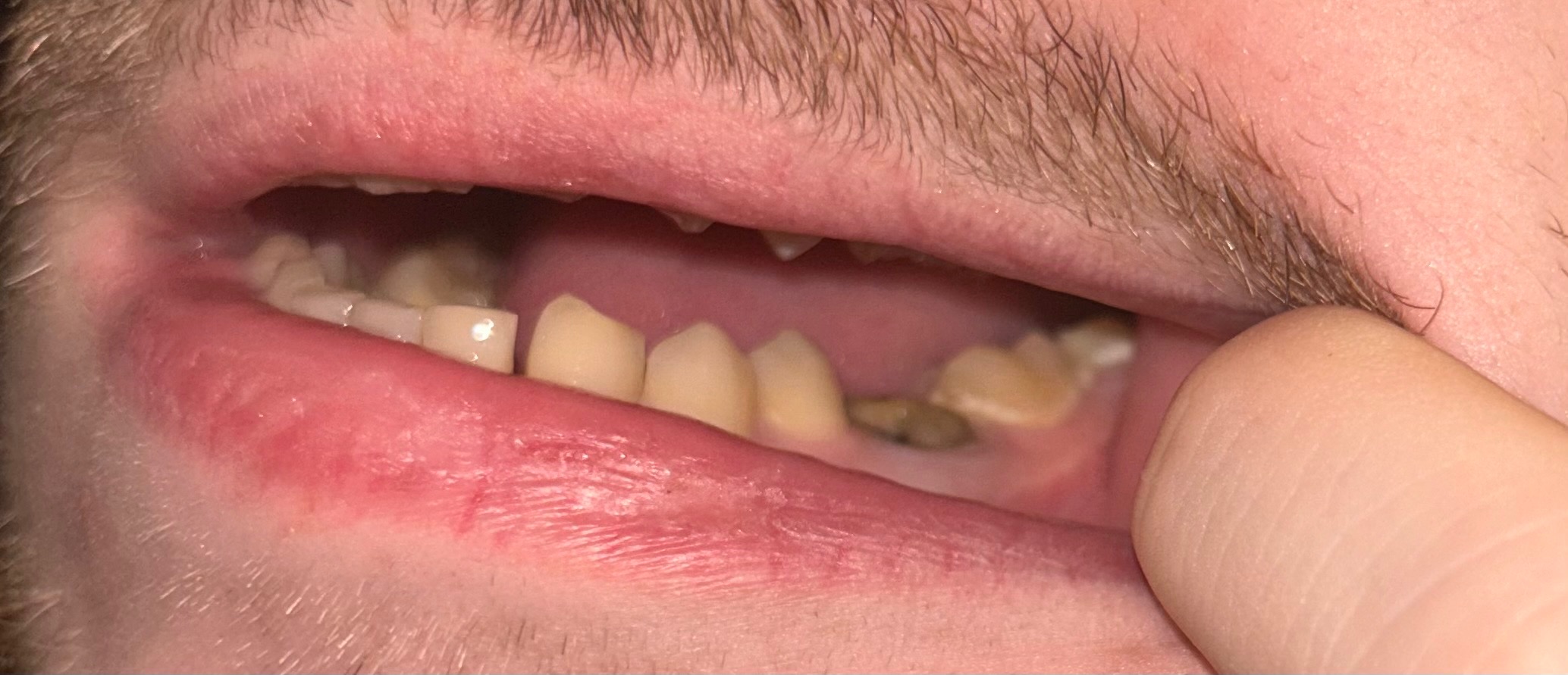 Healthy Smiles for Morgan and Micah campaign photo, 2 of 10