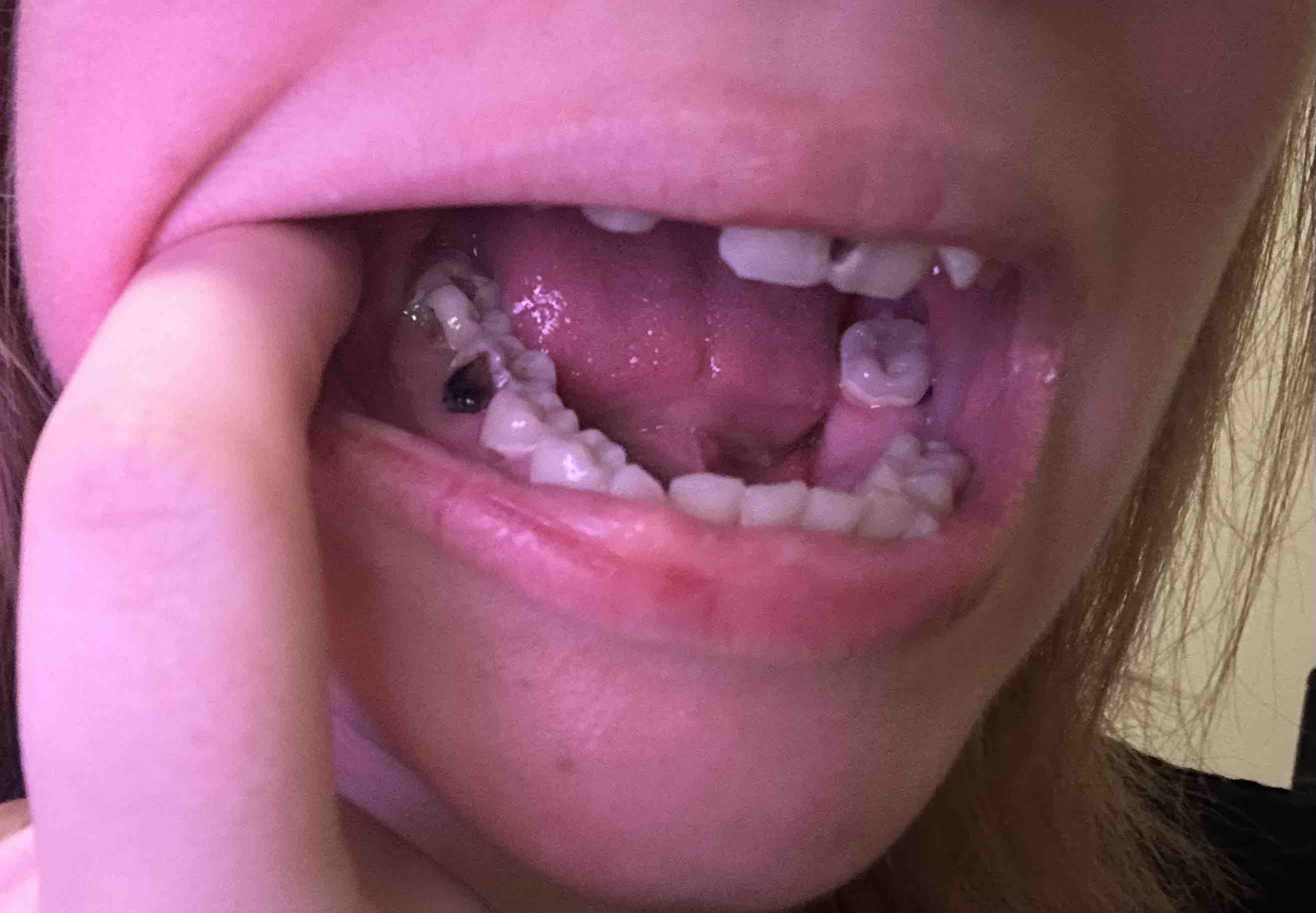 Healthy Smiles for Morgan and Micah campaign photo, 5 of 10