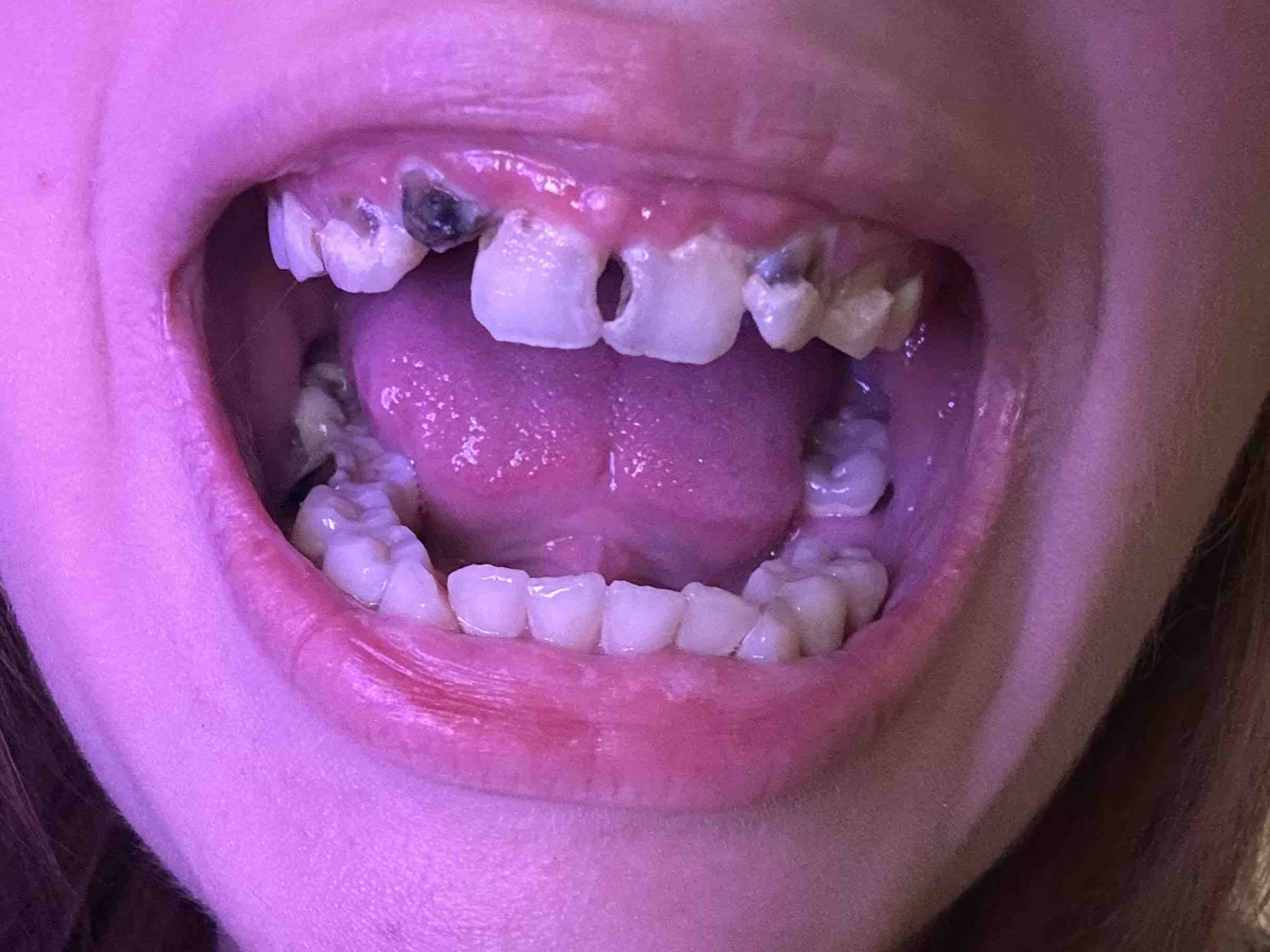 Healthy Smiles for Morgan and Micah campaign photo, 6 of 10