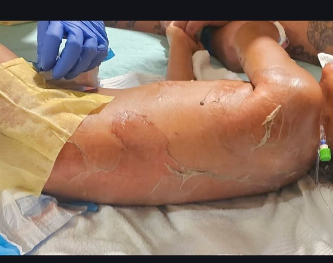 Support Jamal’s Recovery and Ongoing Care campaign photo, 5 of 6