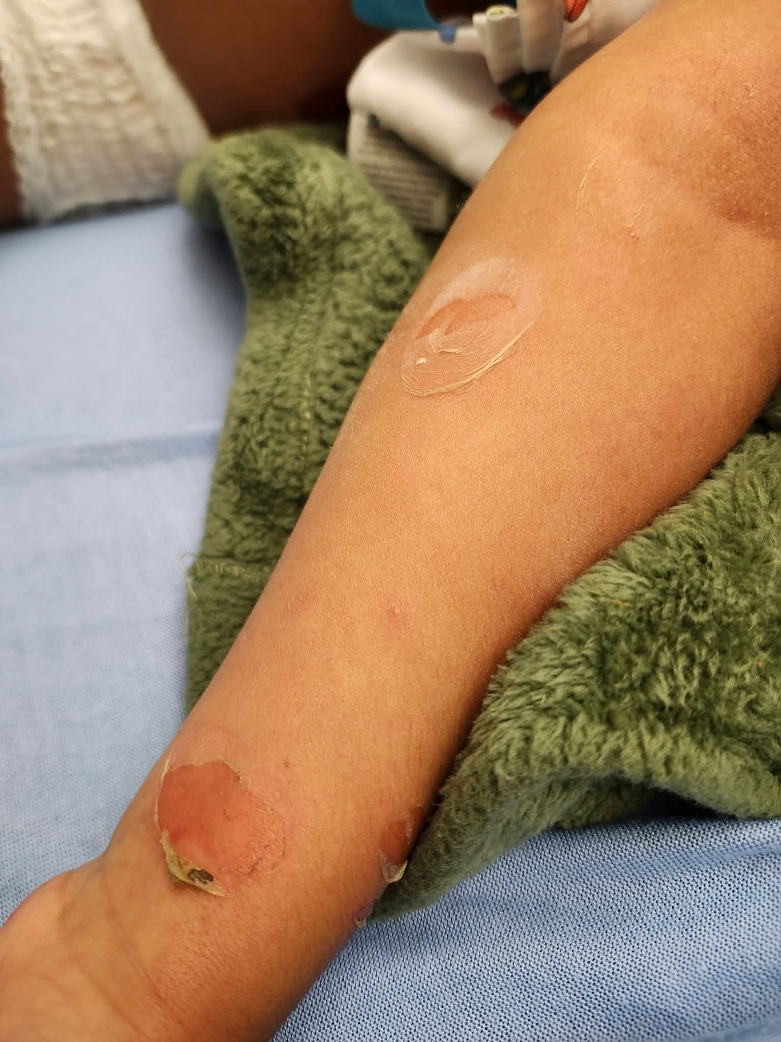 Support Jamal’s Recovery and Ongoing Care campaign photo, 2 of 6