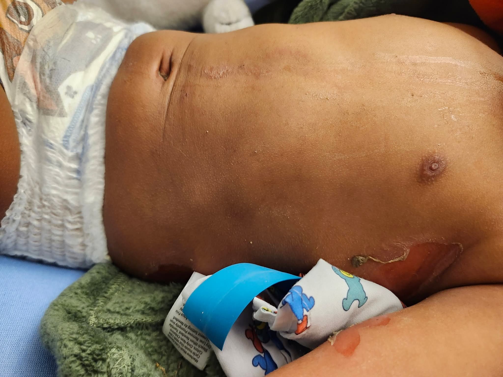 Support Jamal’s Recovery and Ongoing Care campaign photo, 4 of 6