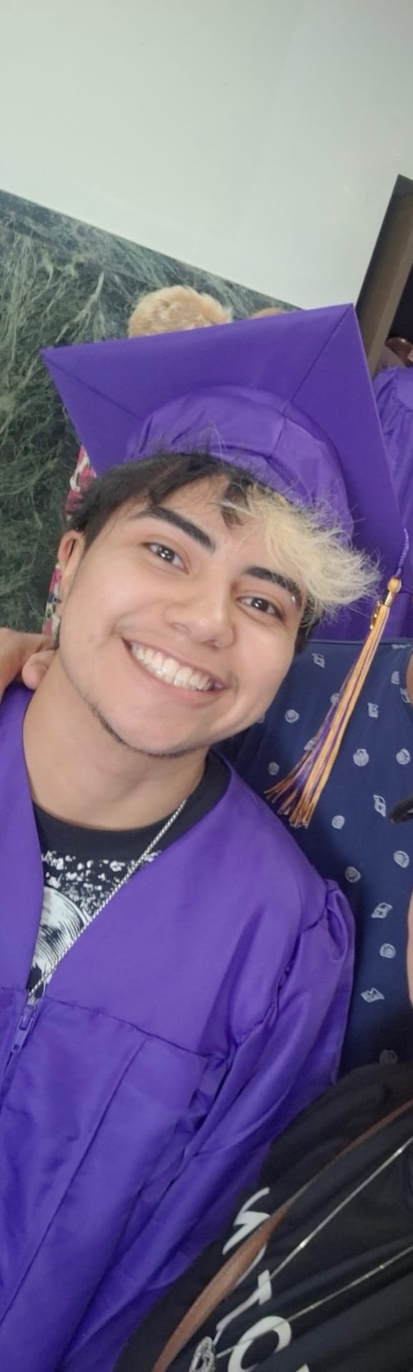 Grayson's Journey to Top Surgery FTM campaign photo, 5 of 6