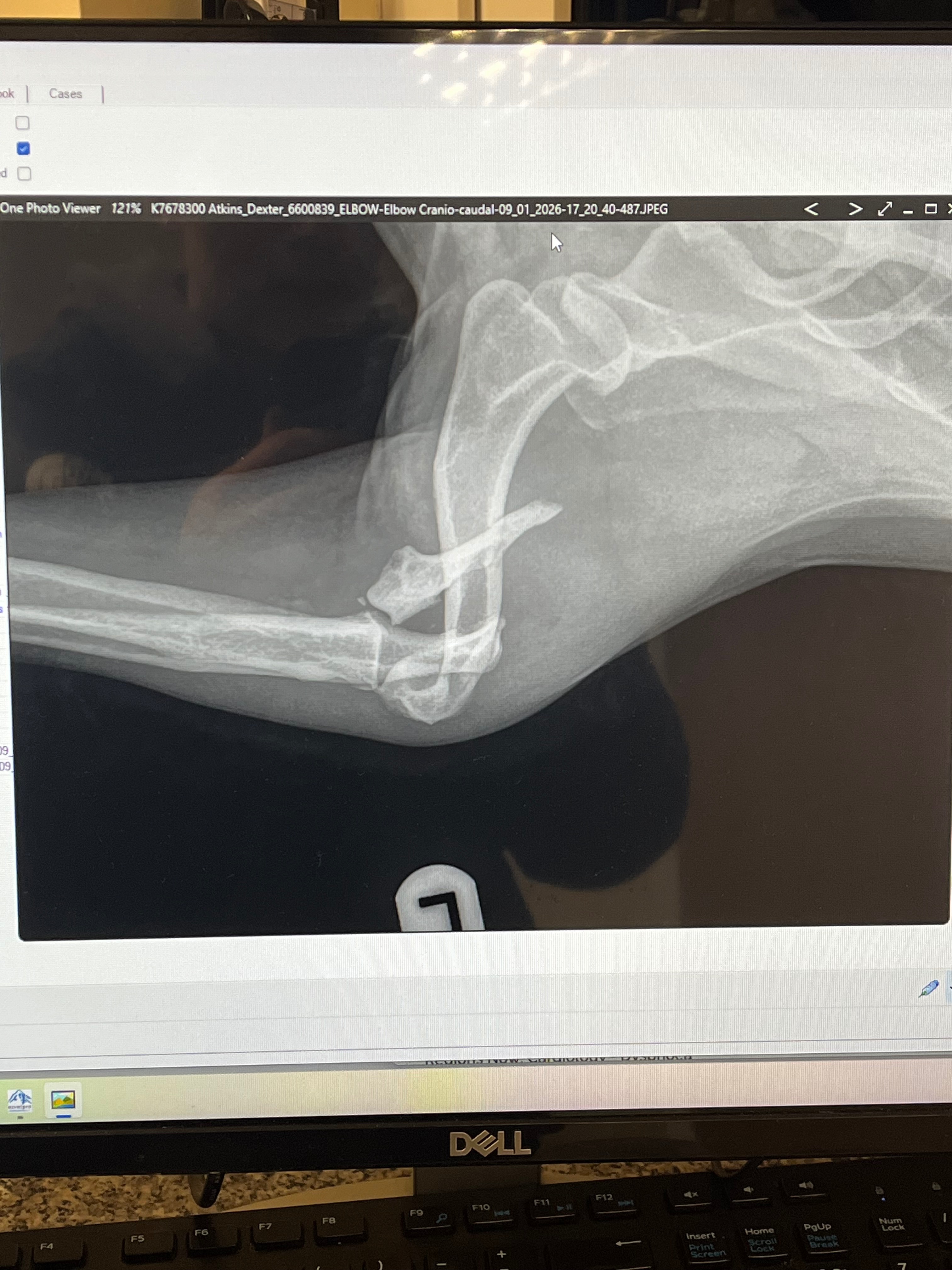 HELP our cocker Dex walk again. campaign photo, 6 of 8
