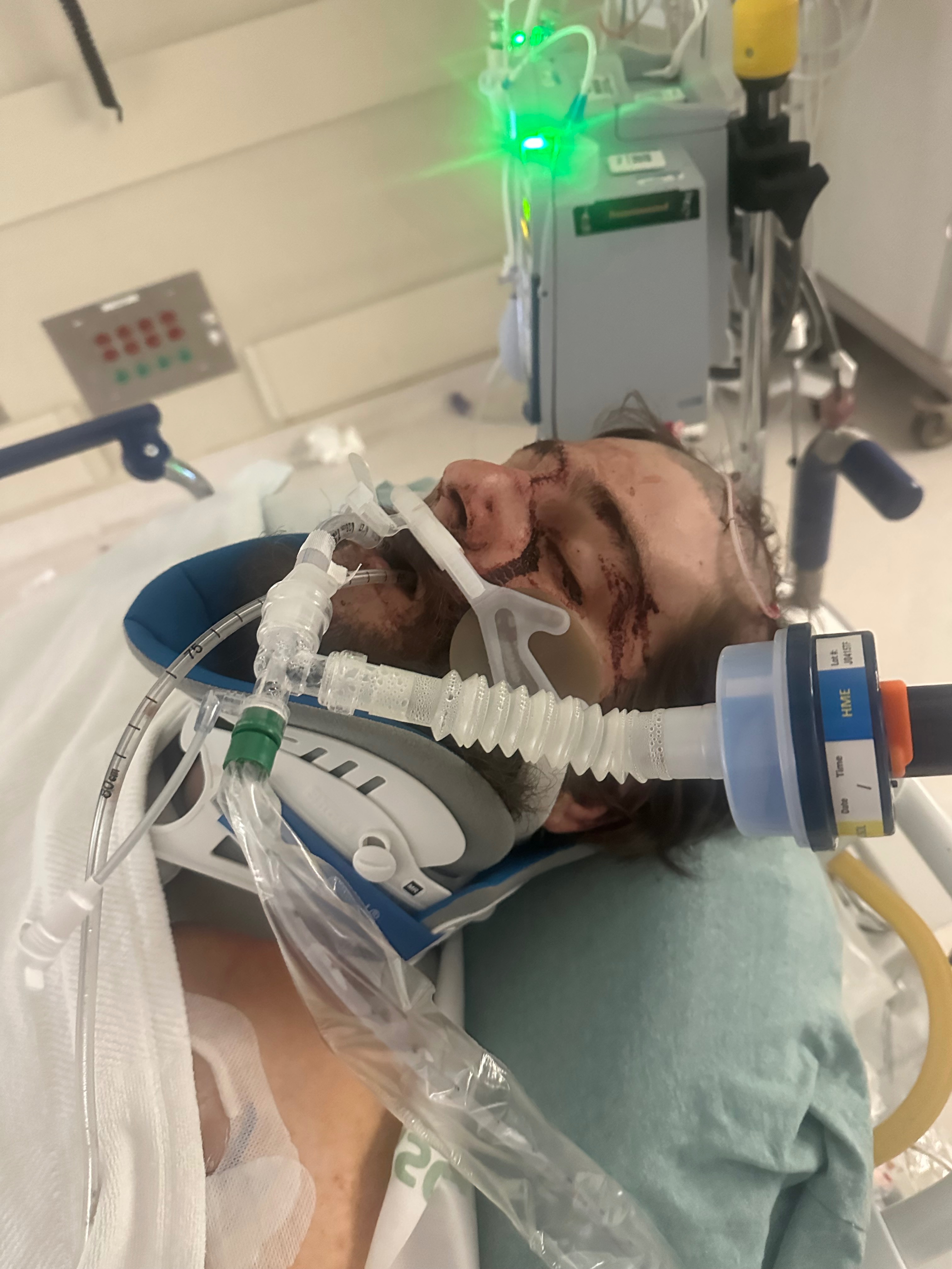 Support Nick Allen’s Fight for Recovery After a Devastating campaign photo, 5 of 8