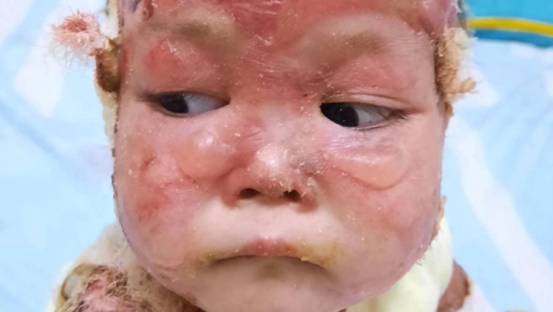Help baby lily photo