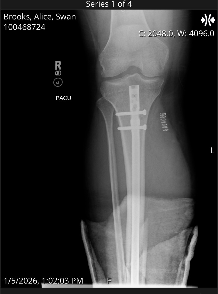 Support Alice’s Recovery After Her Injury campaign photo, 7 of 8