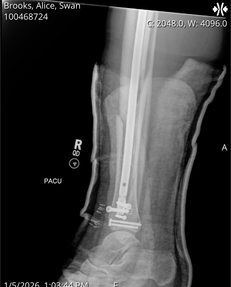 Support Alice’s Recovery After Her Injury campaign photo, 2 of 8