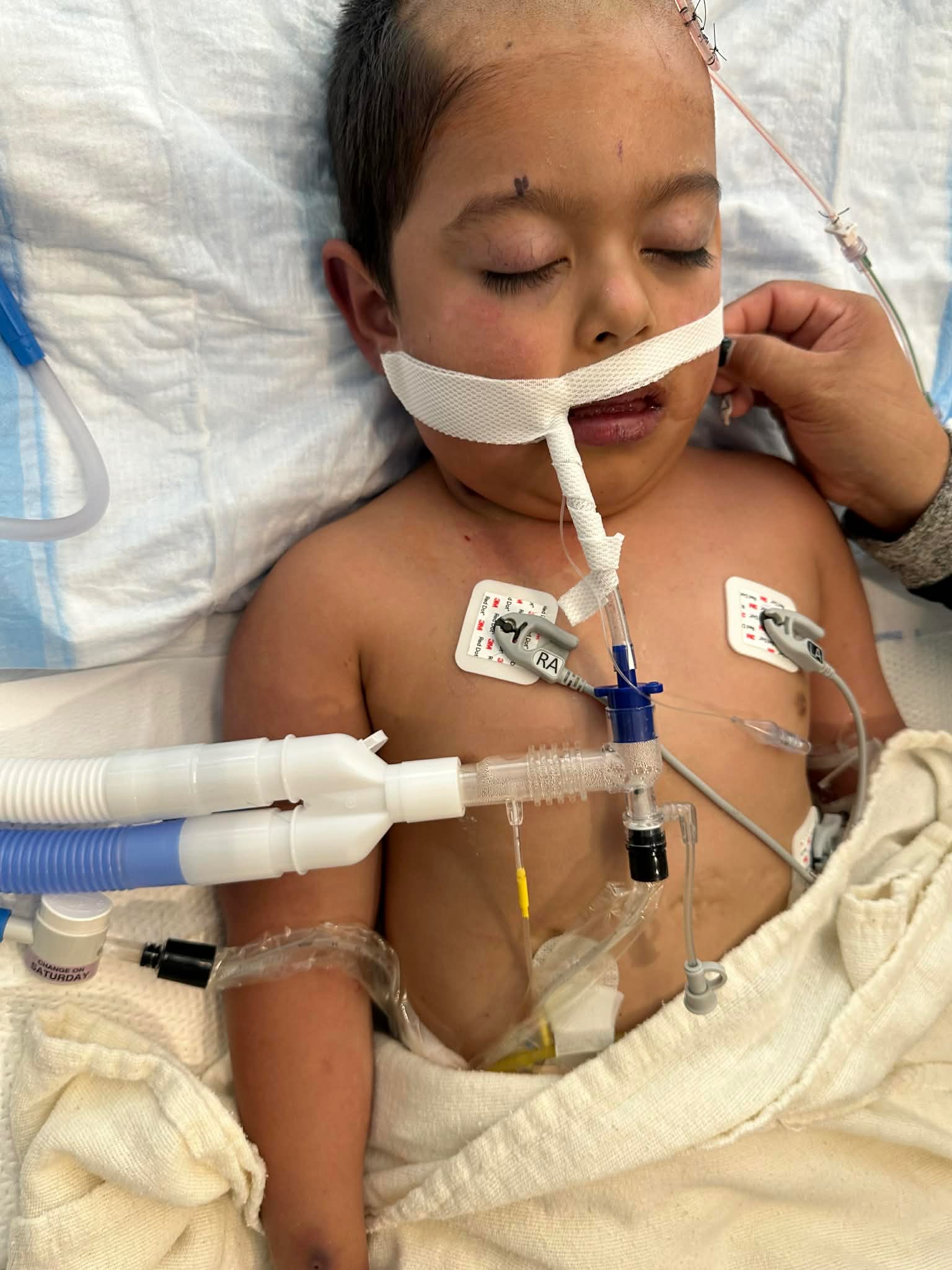 Standing with Caleb in His Brave Battle campaign photo, 5 of 8
