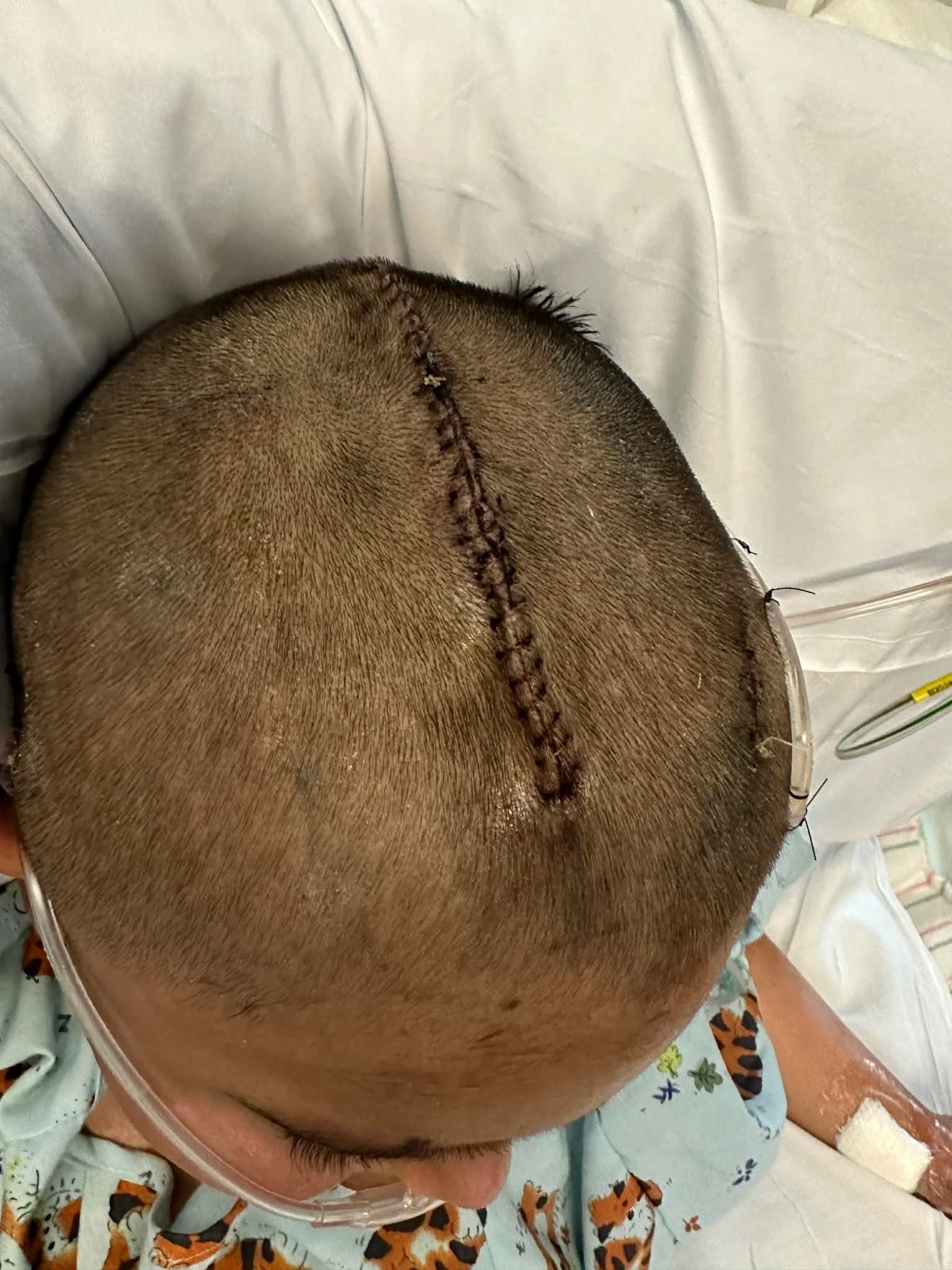 Standing with Caleb in His Brave Battle campaign photo, 4 of 8