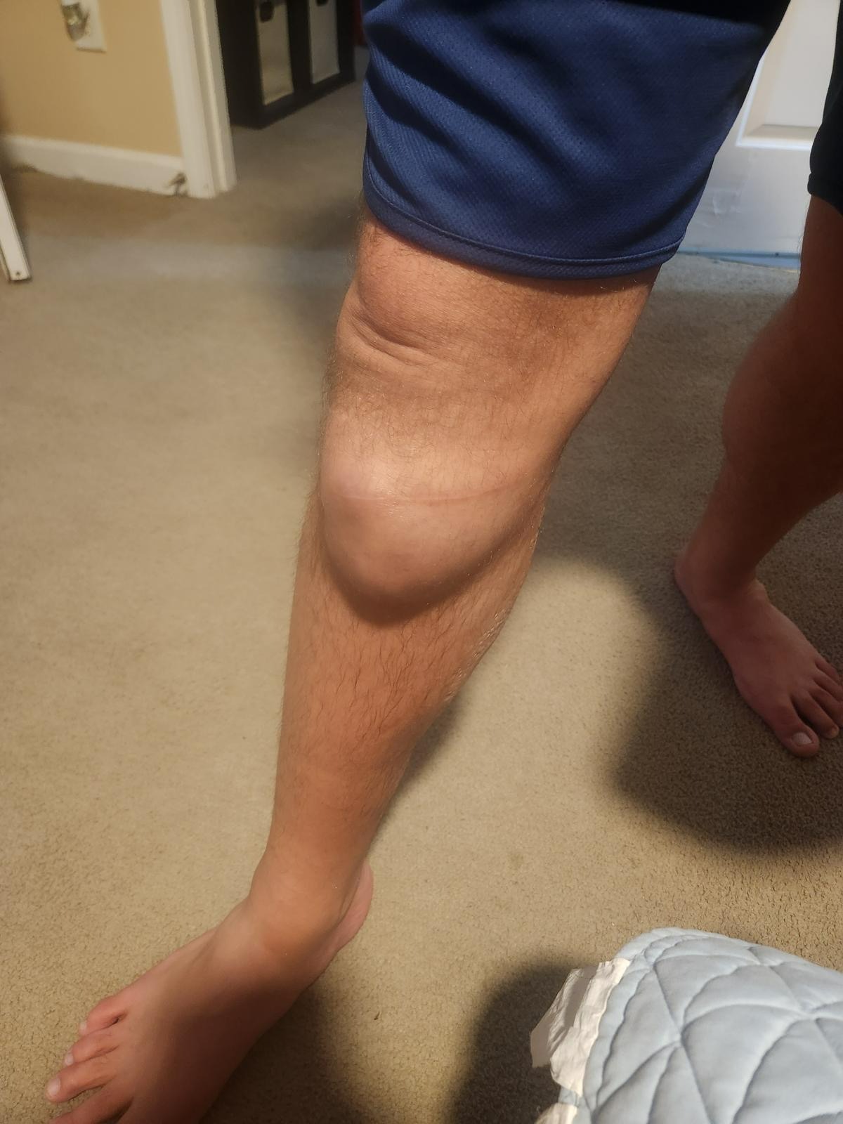 Help Uriel Rebuild After Amputation campaign photo, 2 of 8