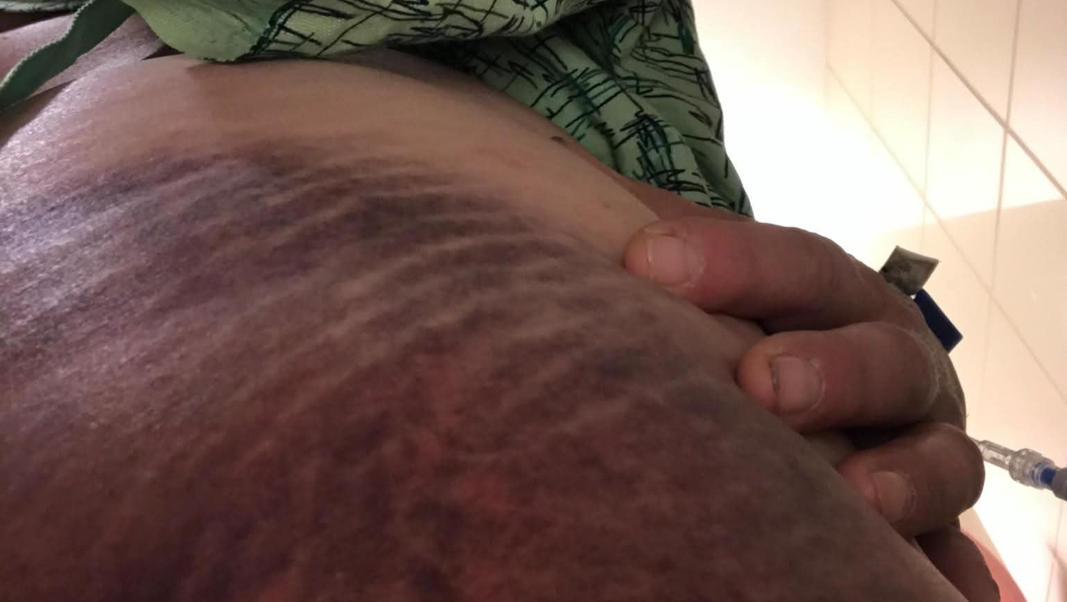 Help Jill Recover and Rebuild After Trauma photo