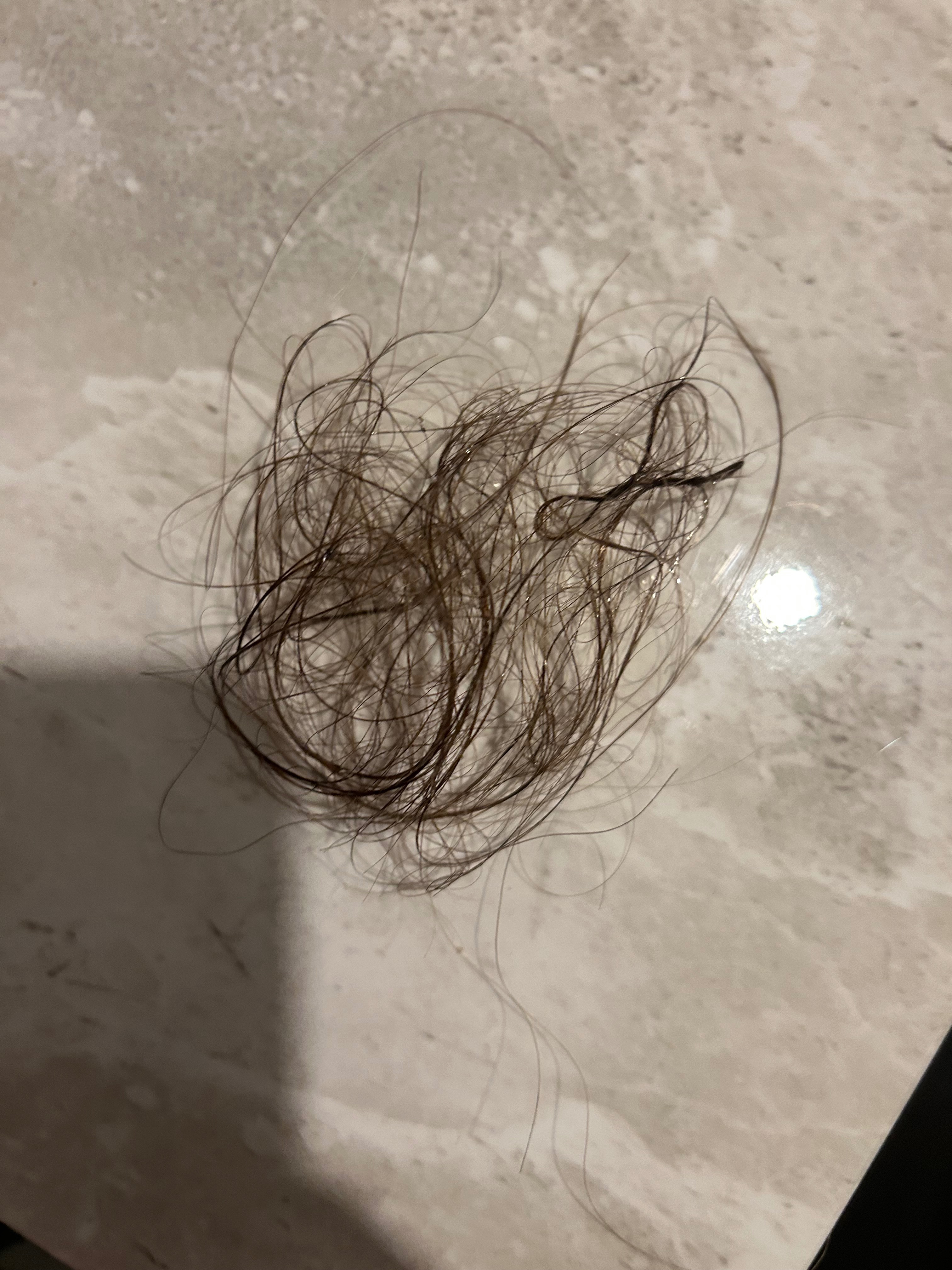 Alopecia campaign photo, 7 of 7