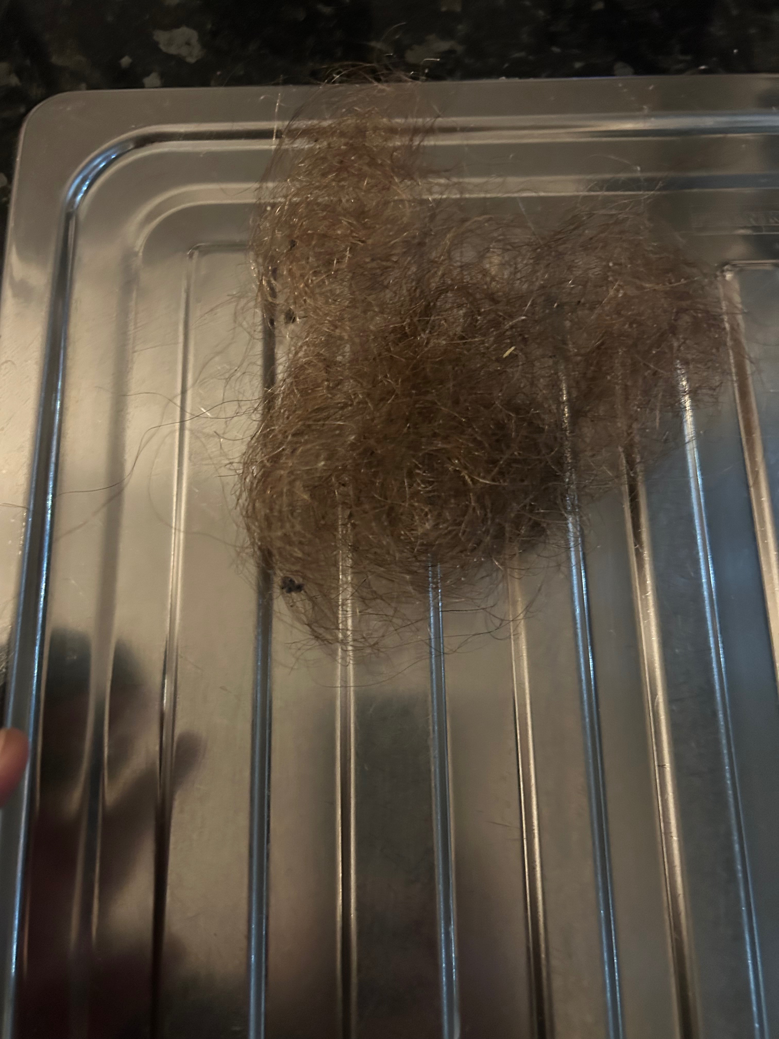 Alopecia campaign photo, 2 of 7