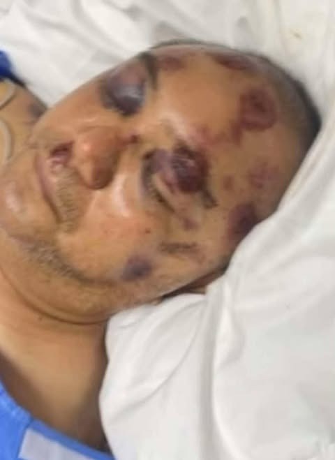 Urgent Help Needed for Life-Saving Surgery campaign photo, 2 of 5
