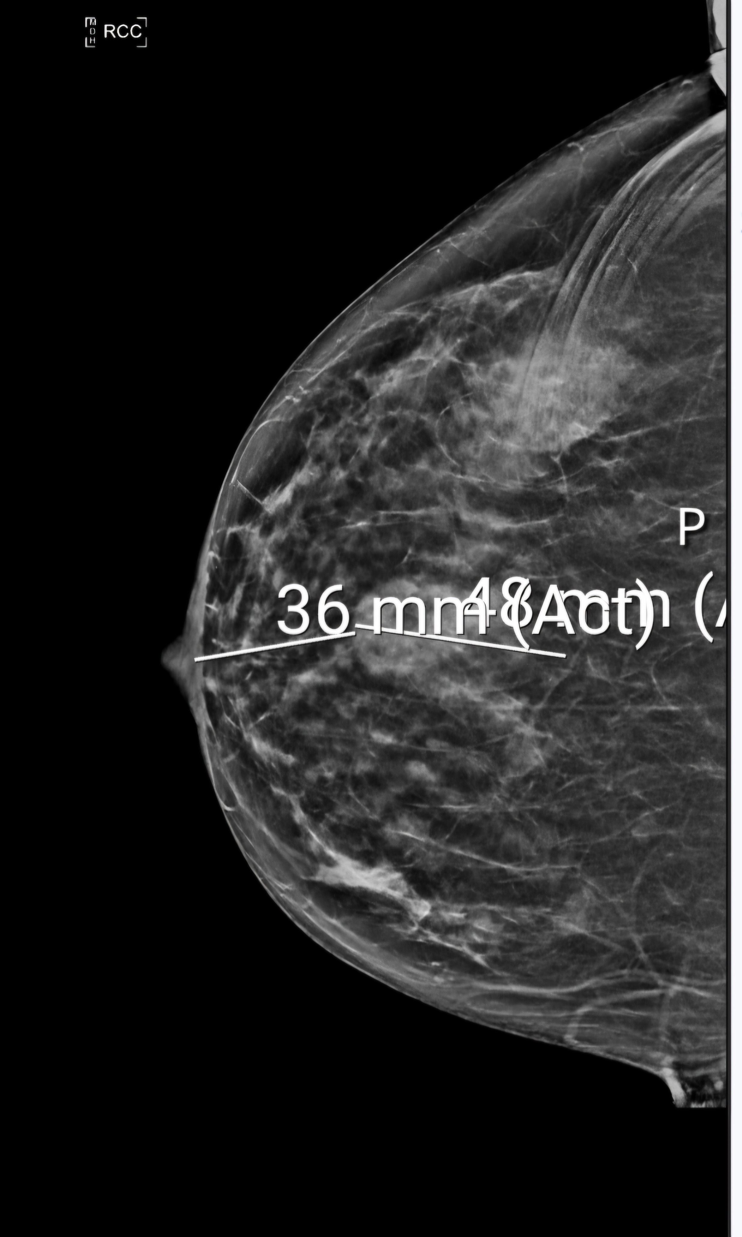 Support April Berry's Fight Against Breast Cancer campaign photo, 6 of 8