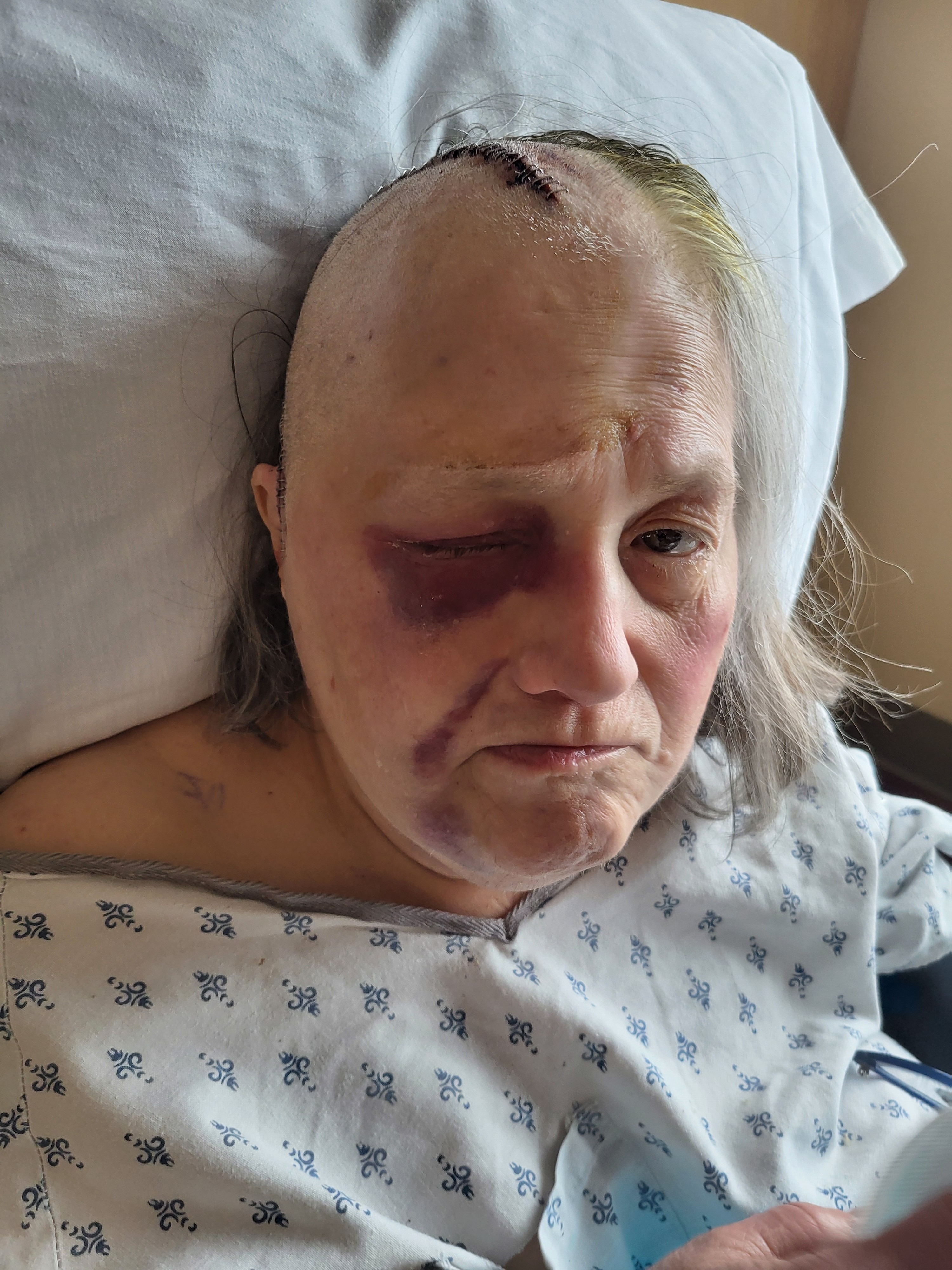 Support Nancy’s Healing Journey campaign photo, 2 of 8