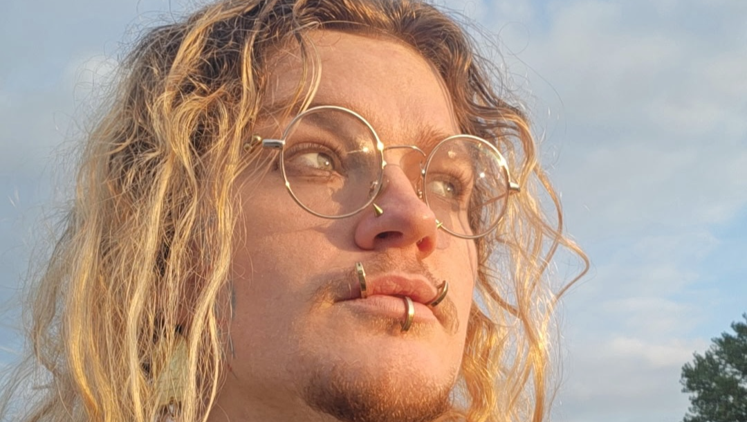 Help Atticus with Living Expenses During Disability Claim photo