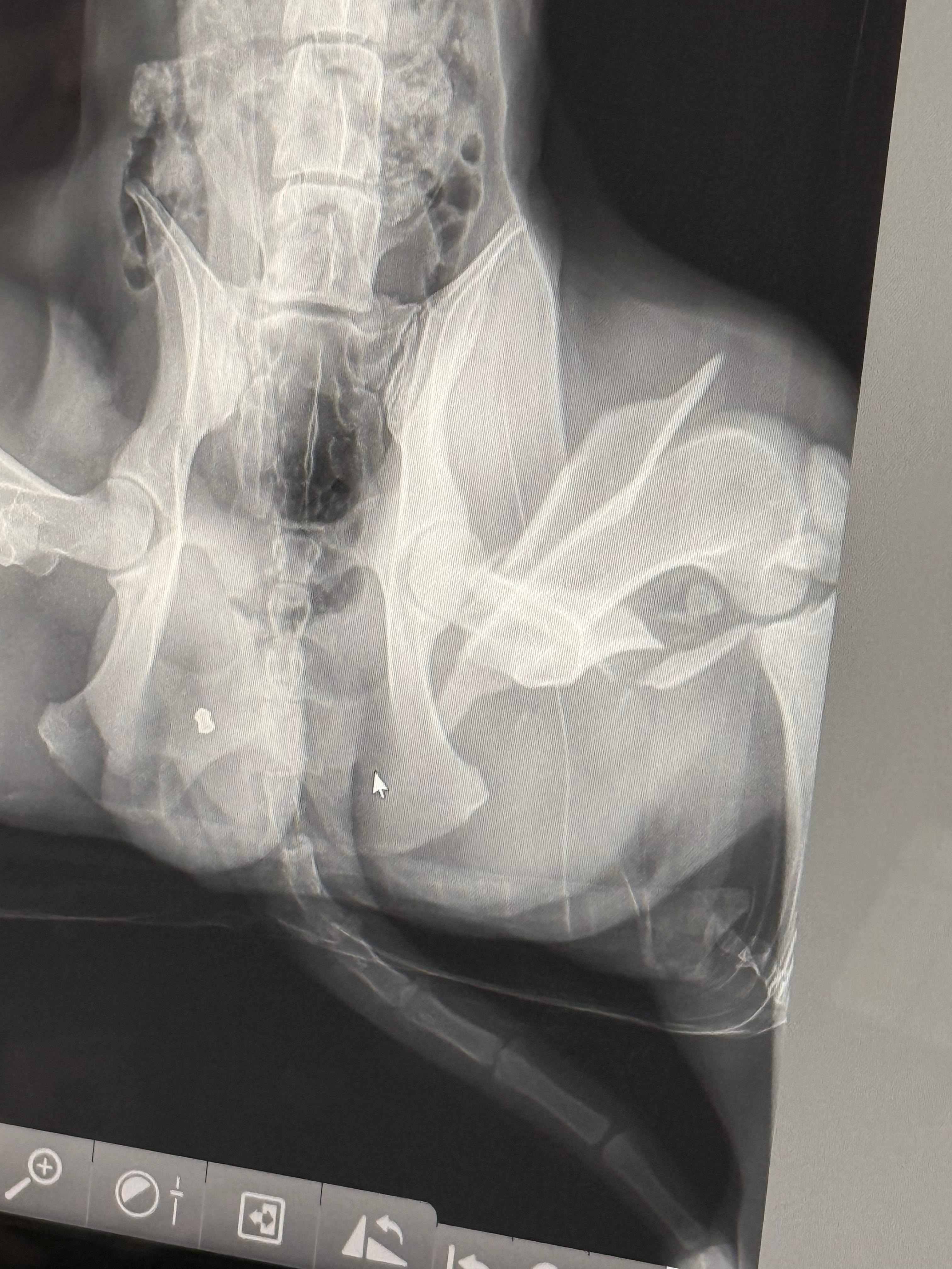 Support Juice’s Surgery After Being Shot campaign photo, 4 of 8