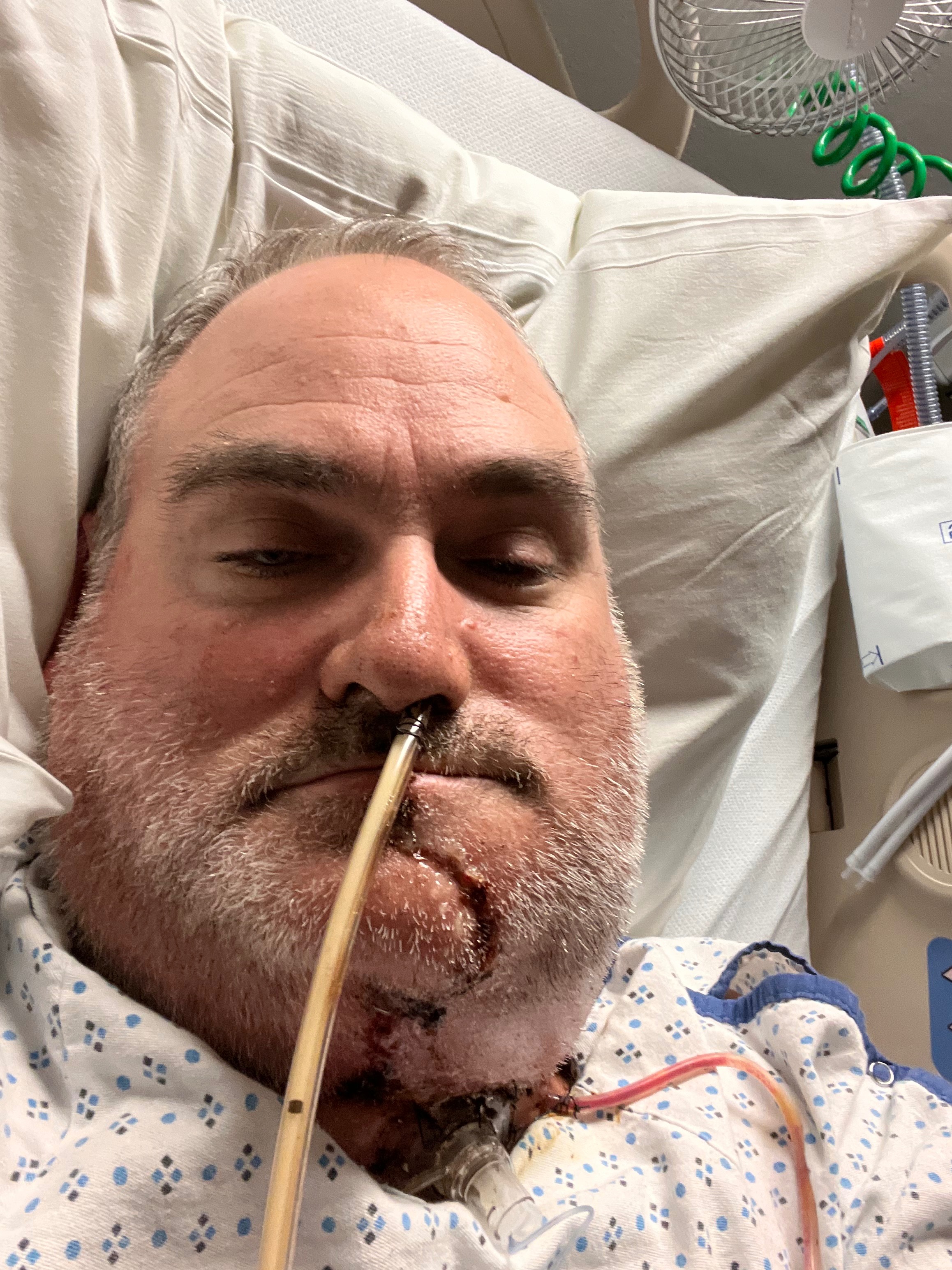 Send Mike to Houston for Critical Cancer Surgery campaign photo, 2 of 6