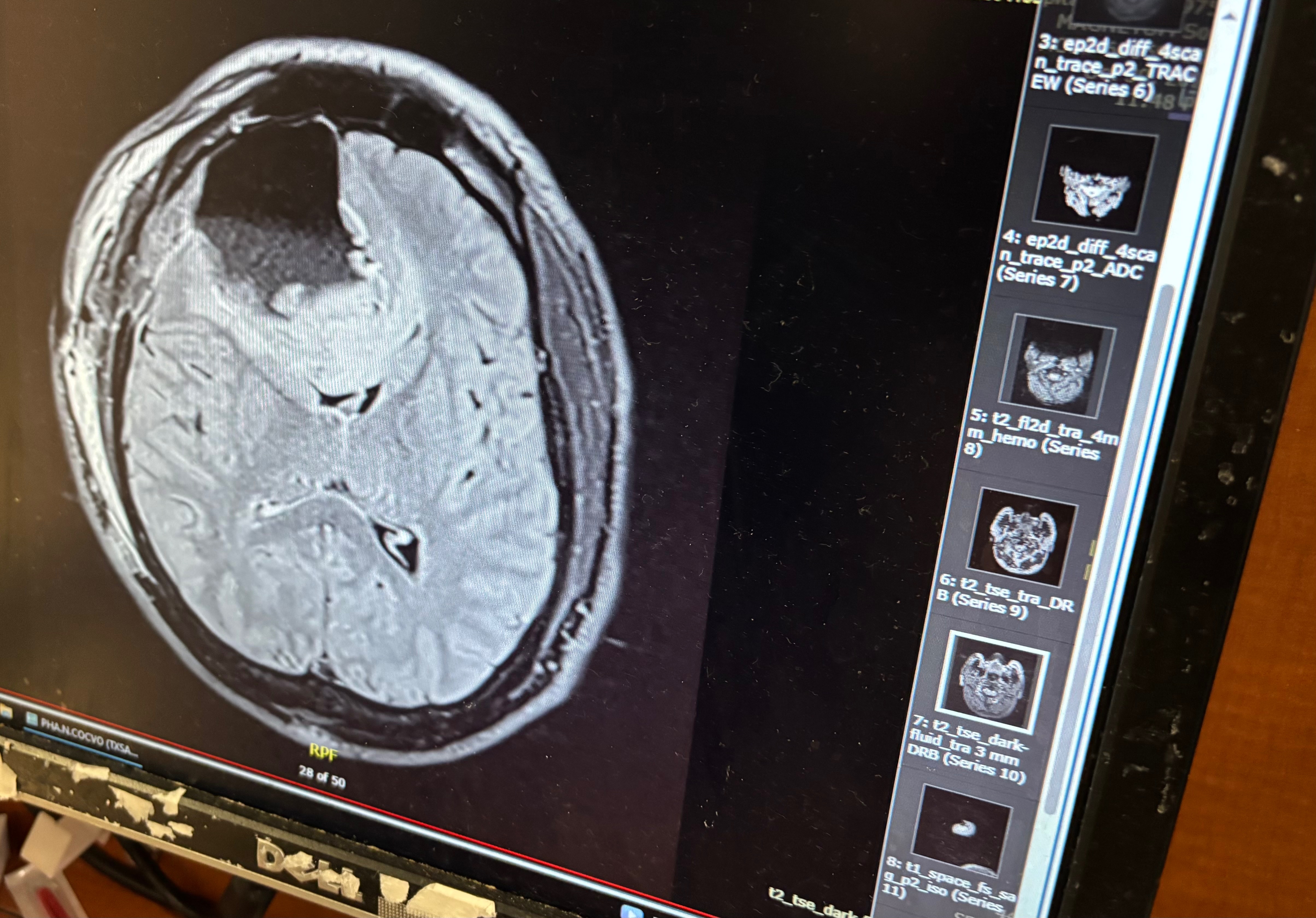 Support Eric’s Fight Against Brain Cancer campaign photo, 7 of 8
