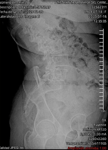 Ayuda a Carmen necesita operación para evitar invalidez campaign photo, 2 of 5
