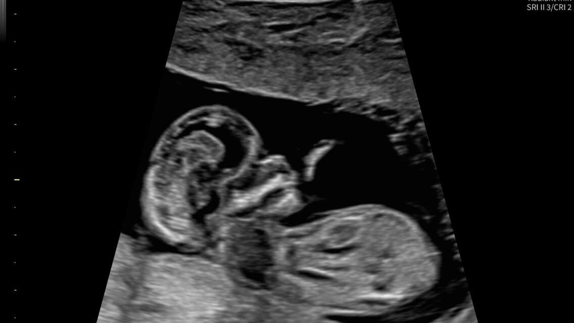 In desperate need of help! photo