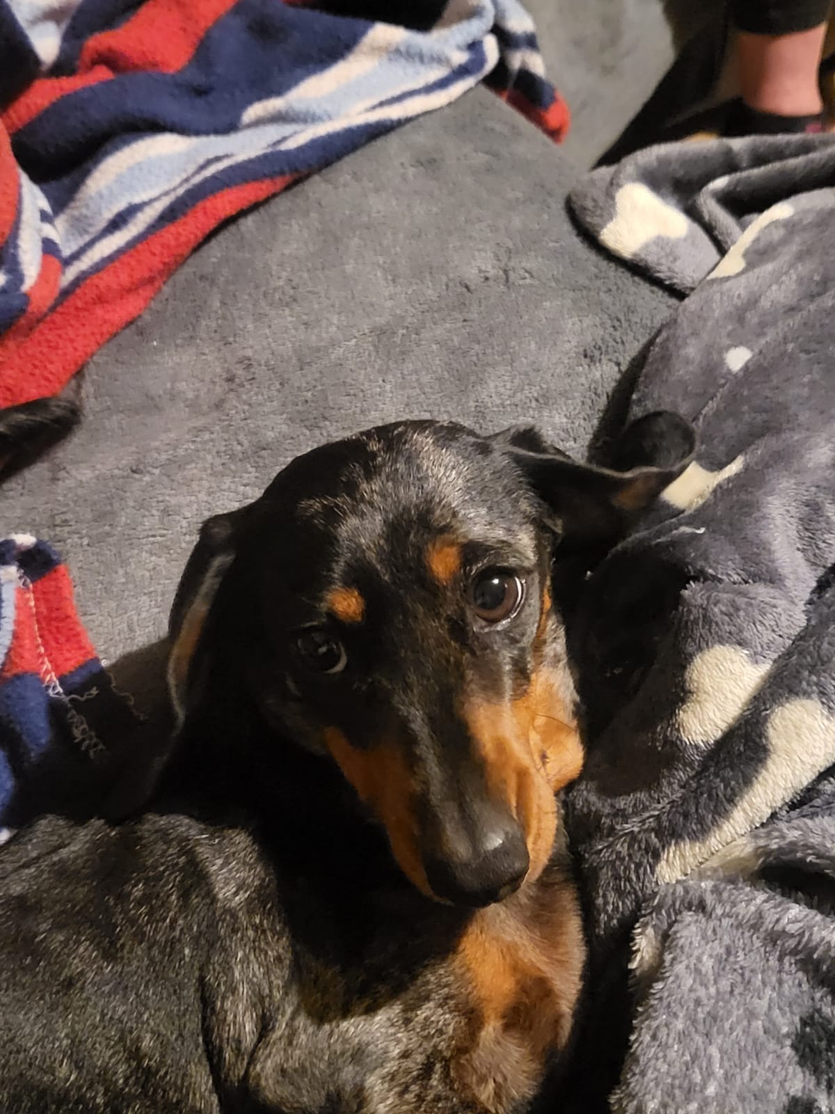 Help support Willow's IVDD rehabilitation campaign photo, 6 of 8