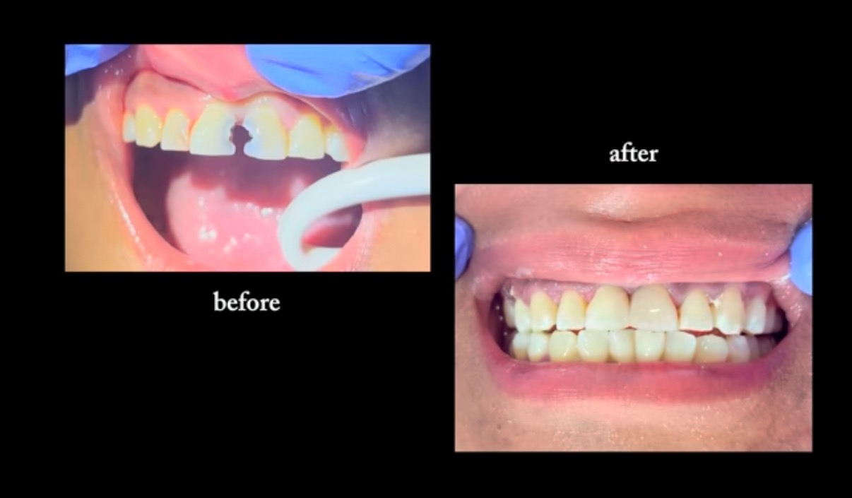Support Hannah’s Dental Mission to Guatemala campaign photo, 4 of 5