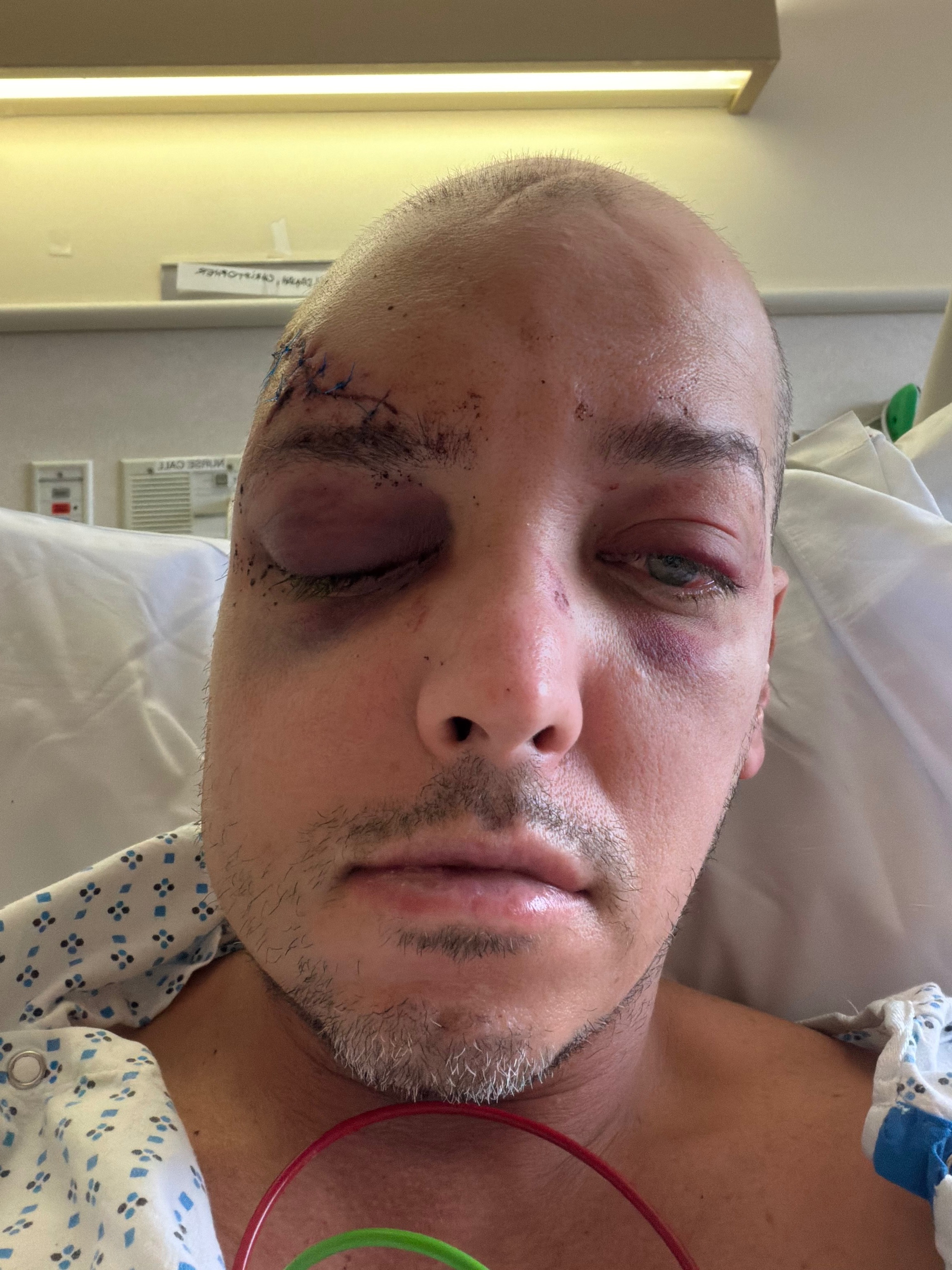 Help Chris (aka Seno) Bridge the Gap During Recovery campaign photo, 7 of 8