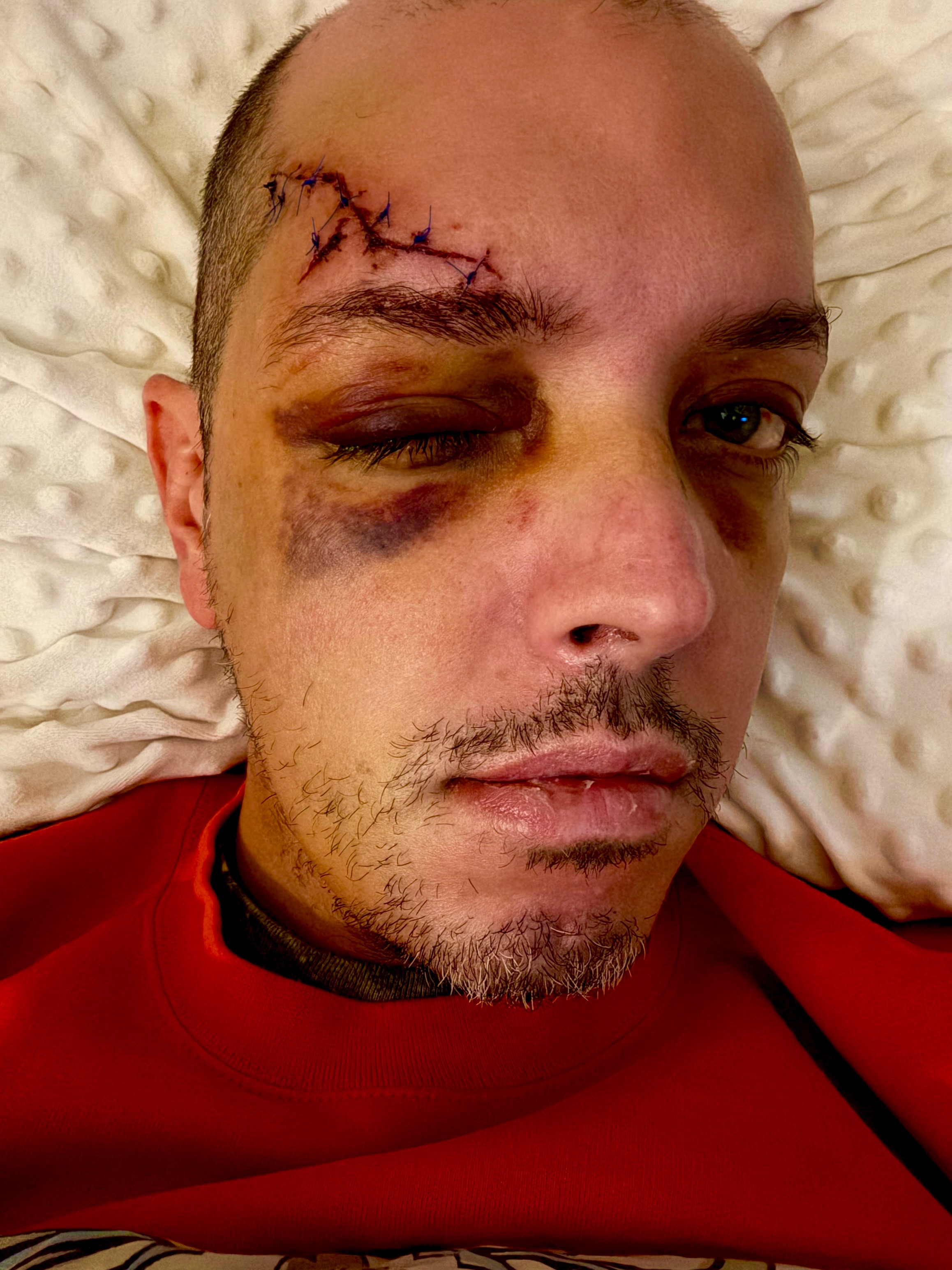 Help Chris (aka Seno) Bridge the Gap During Recovery campaign photo, 5 of 8