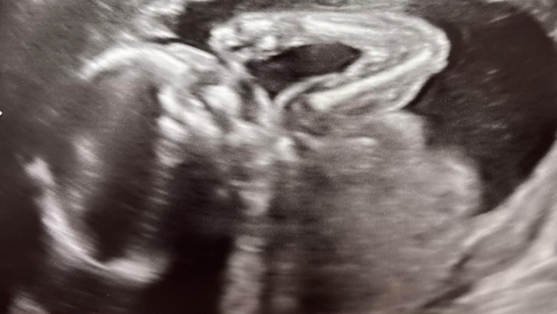 Join Us in Celebrating Baby Milo’s Arrival photo