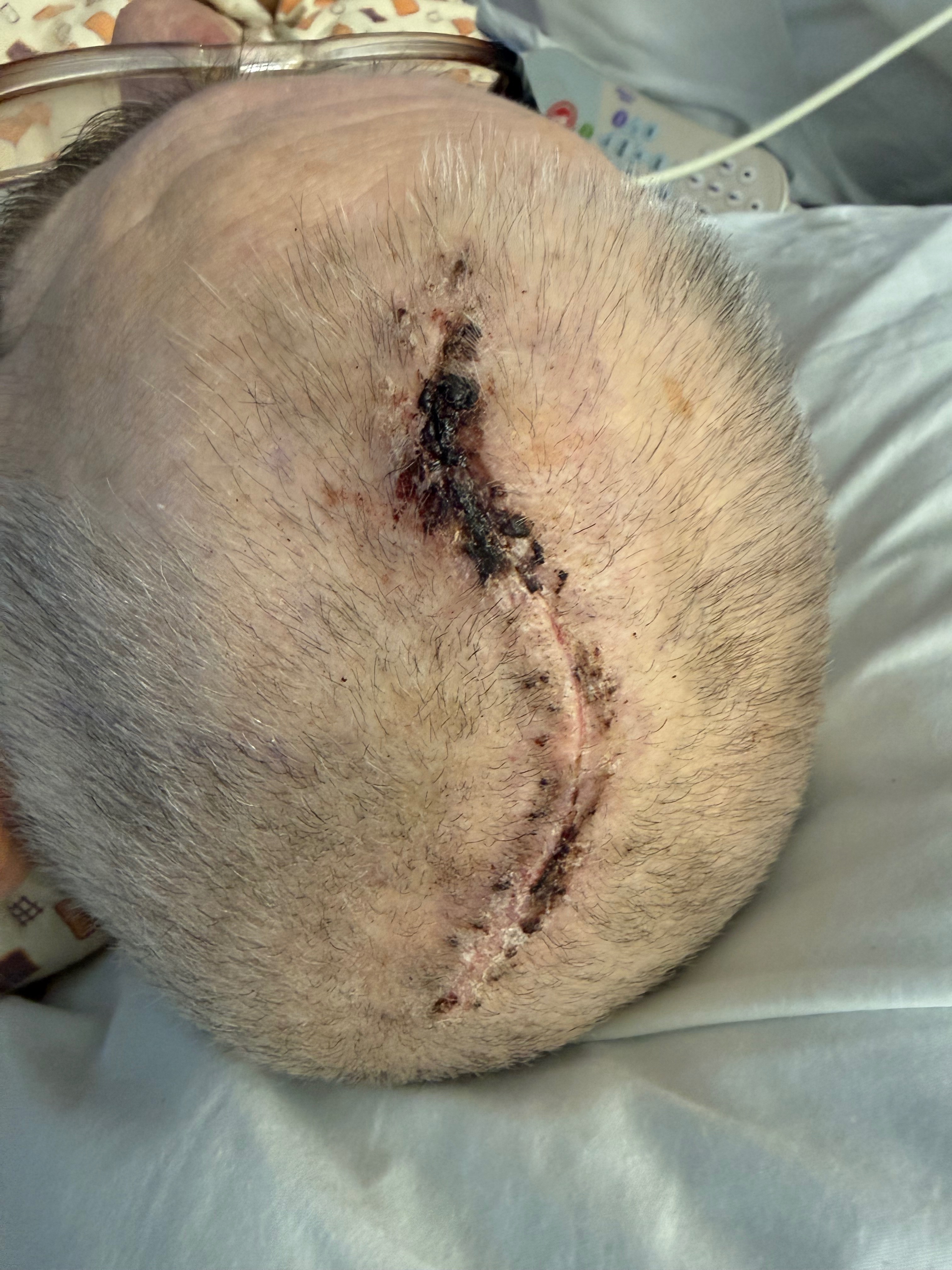 Help our Dad with Glioblastoma & Critical Home Repairs campaign photo, 5 of 6