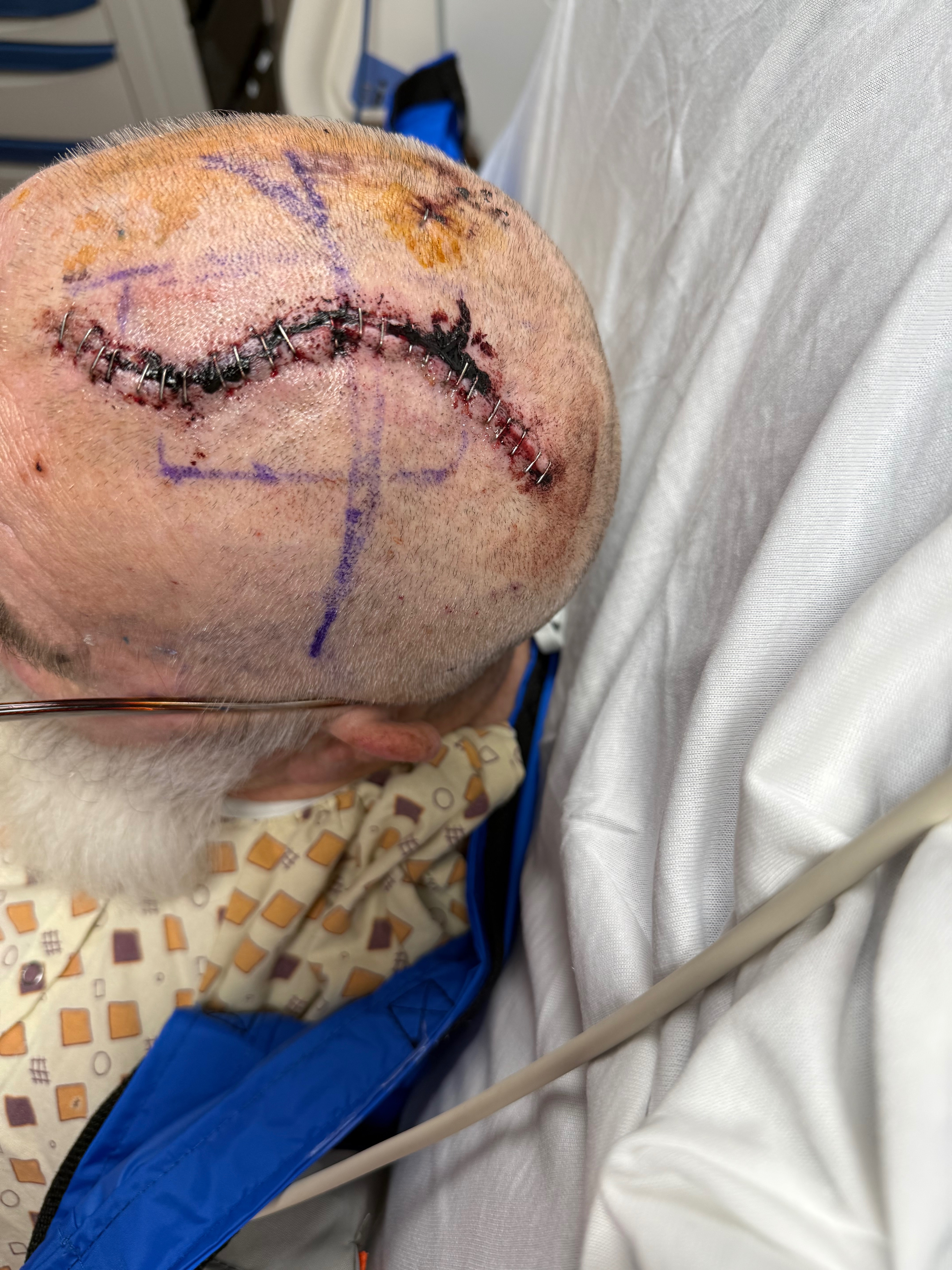 Help our Dad with Glioblastoma & Critical Home Repairs campaign photo, 2 of 6