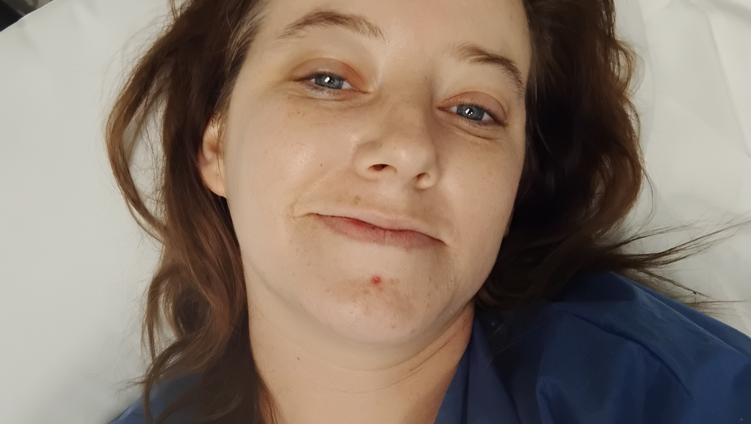 Help Me Smile Through Cancer Recovery photo