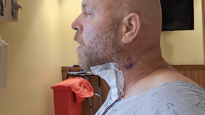 Help John Rebuild After Major Surgeries photo