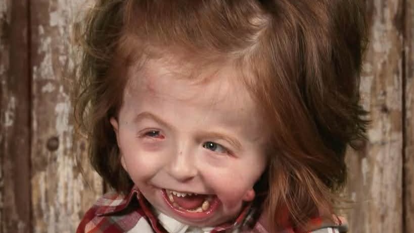Fundraiser for Paige Edinger by Raven Edinger : Support for Bentley's ...