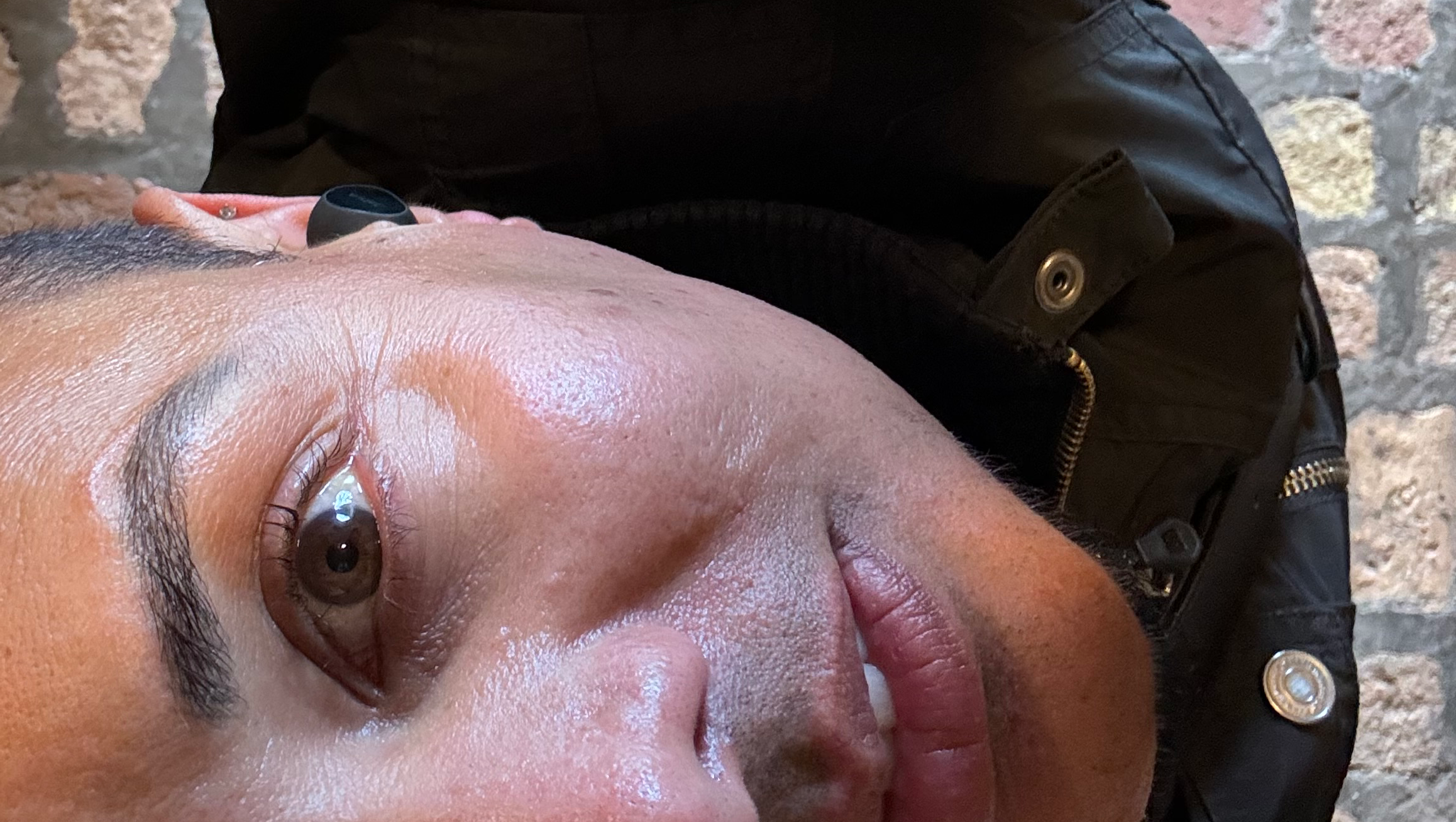 A Life-Changing Surgery. A Chance to Heal. A Call for Help. photo