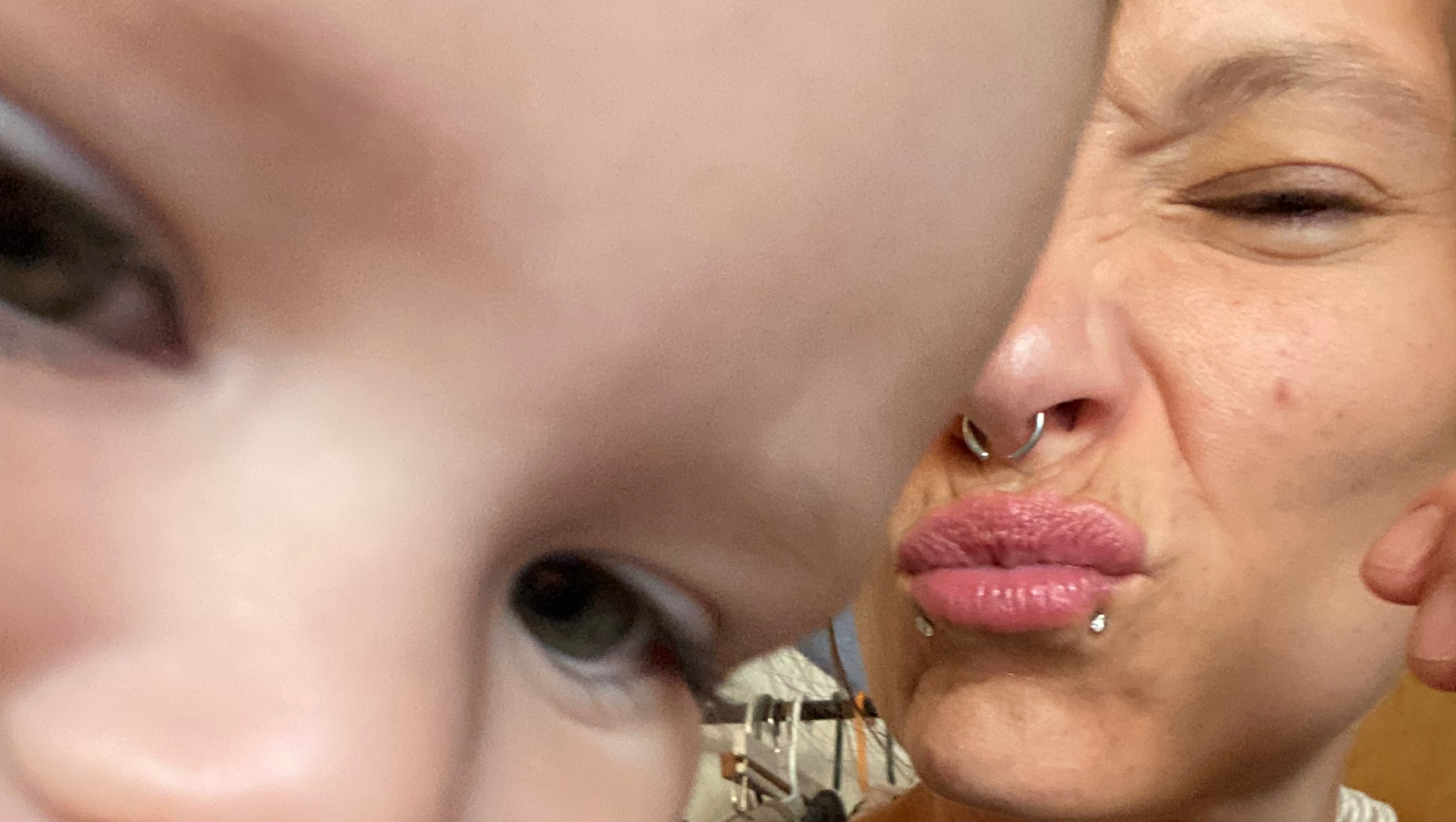 Support Ester's Gene Therapy and Recovery photo