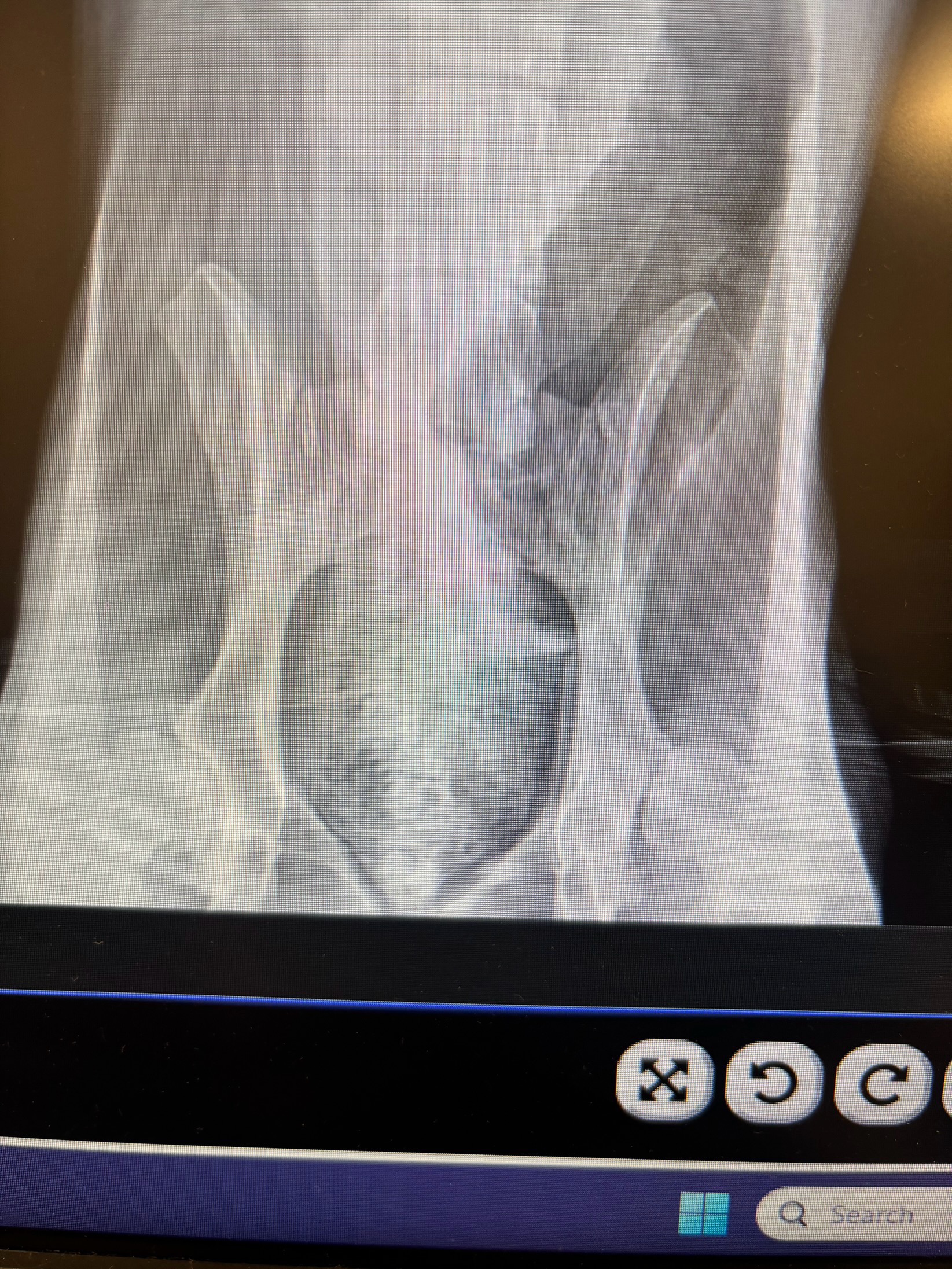 Support Fuzz’s Urgent Hip Dysplasia Surgery campaign photo, 2 of 4