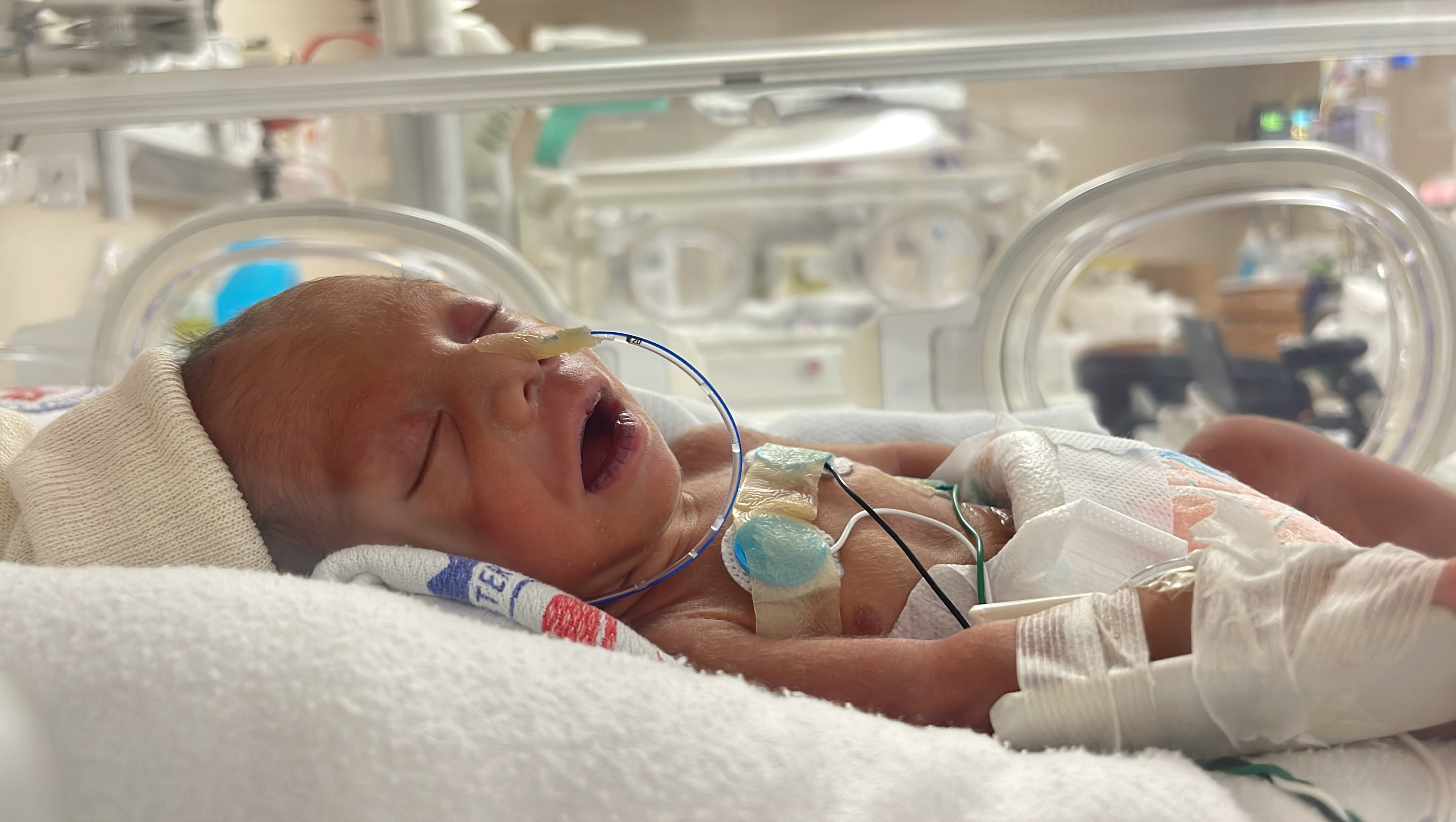Cardinez Fundraiser for Christian Cardinez by Christian Piniano : Born too soon ...