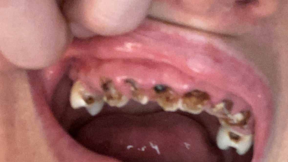 Help Me Get Urgent Dental Care photo
